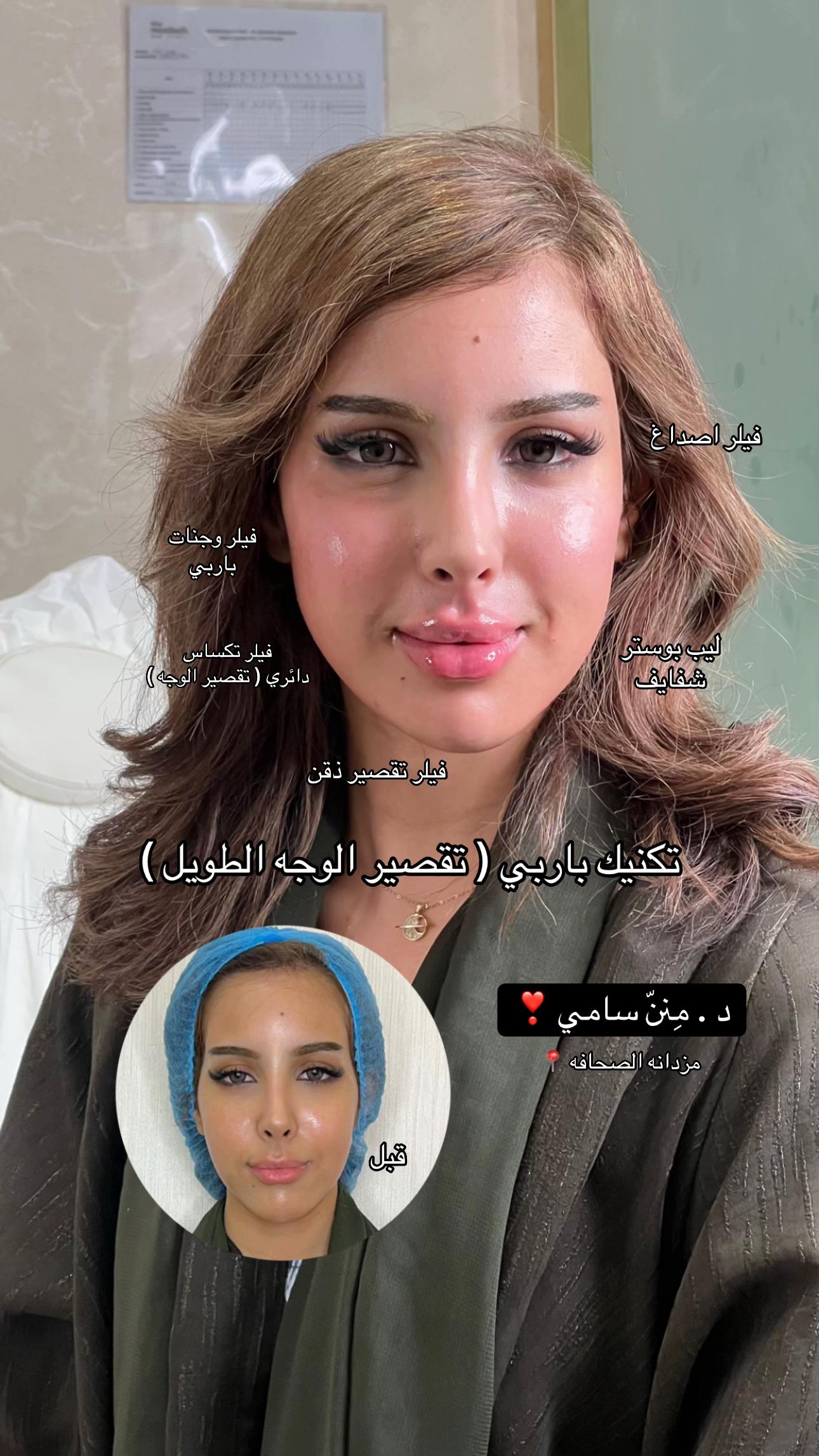 @مركز مزدانه 1 ( فرع الصحافه )