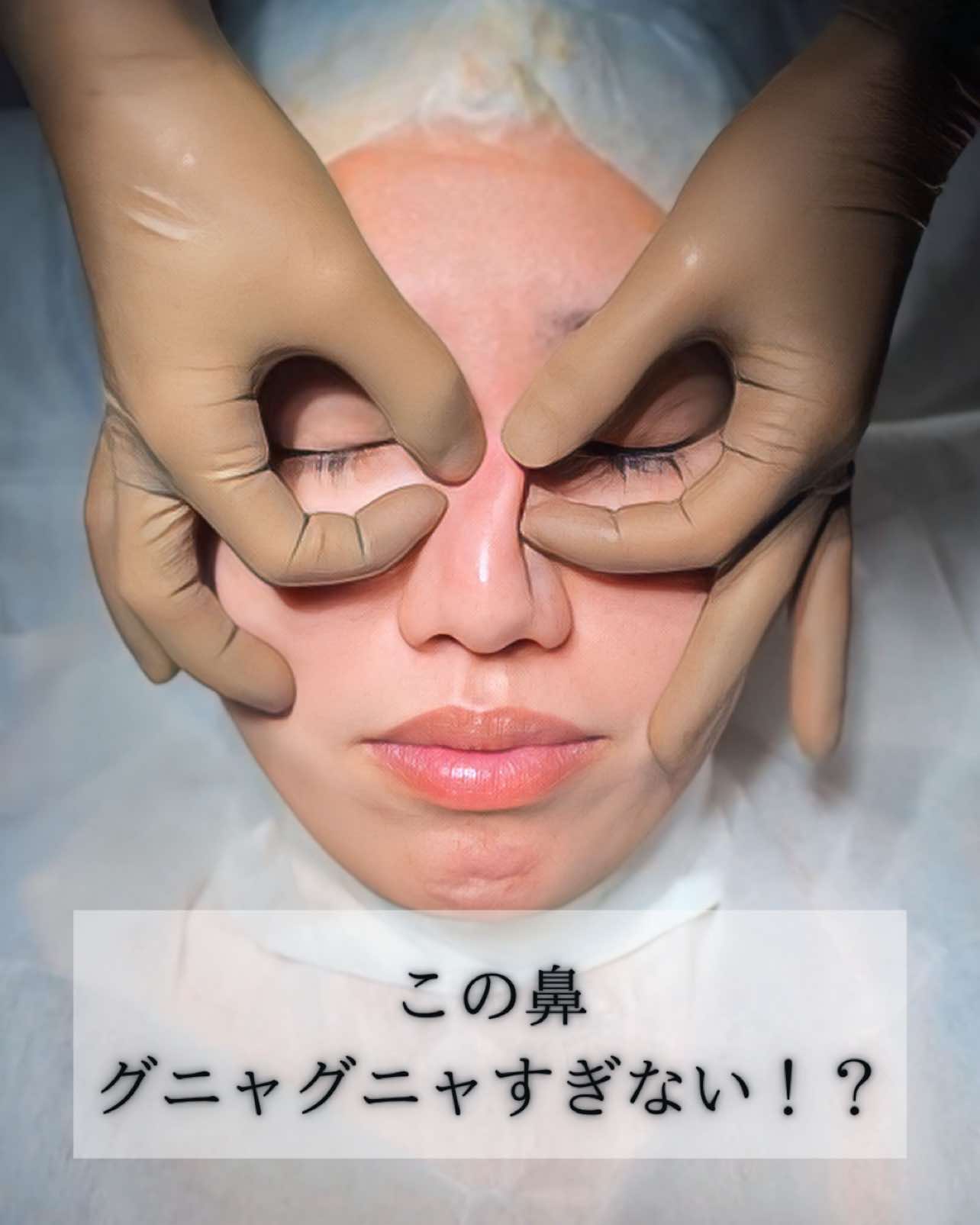 @鼻整形R Beauty CLINIC 副院長👨&zwj;⚕️吉田慧