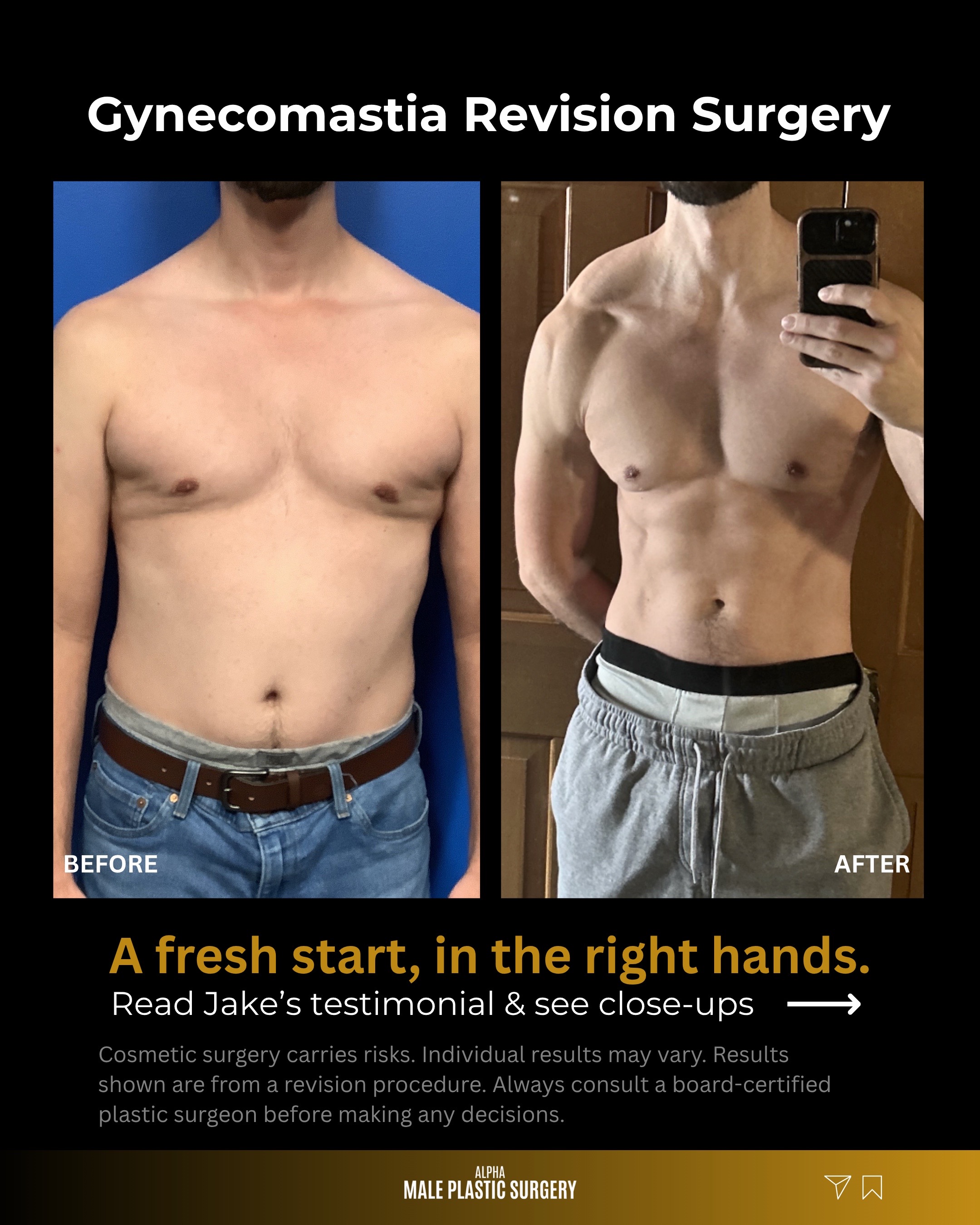 @mensplasticsurgery
