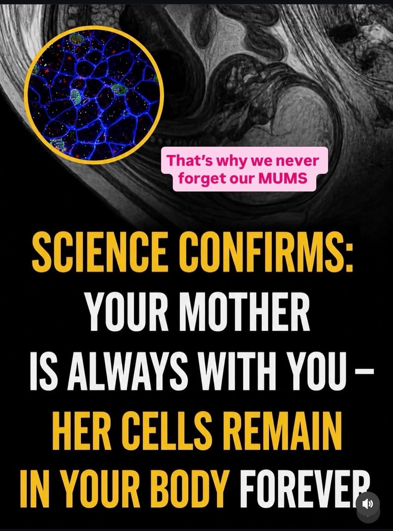 @Aisha