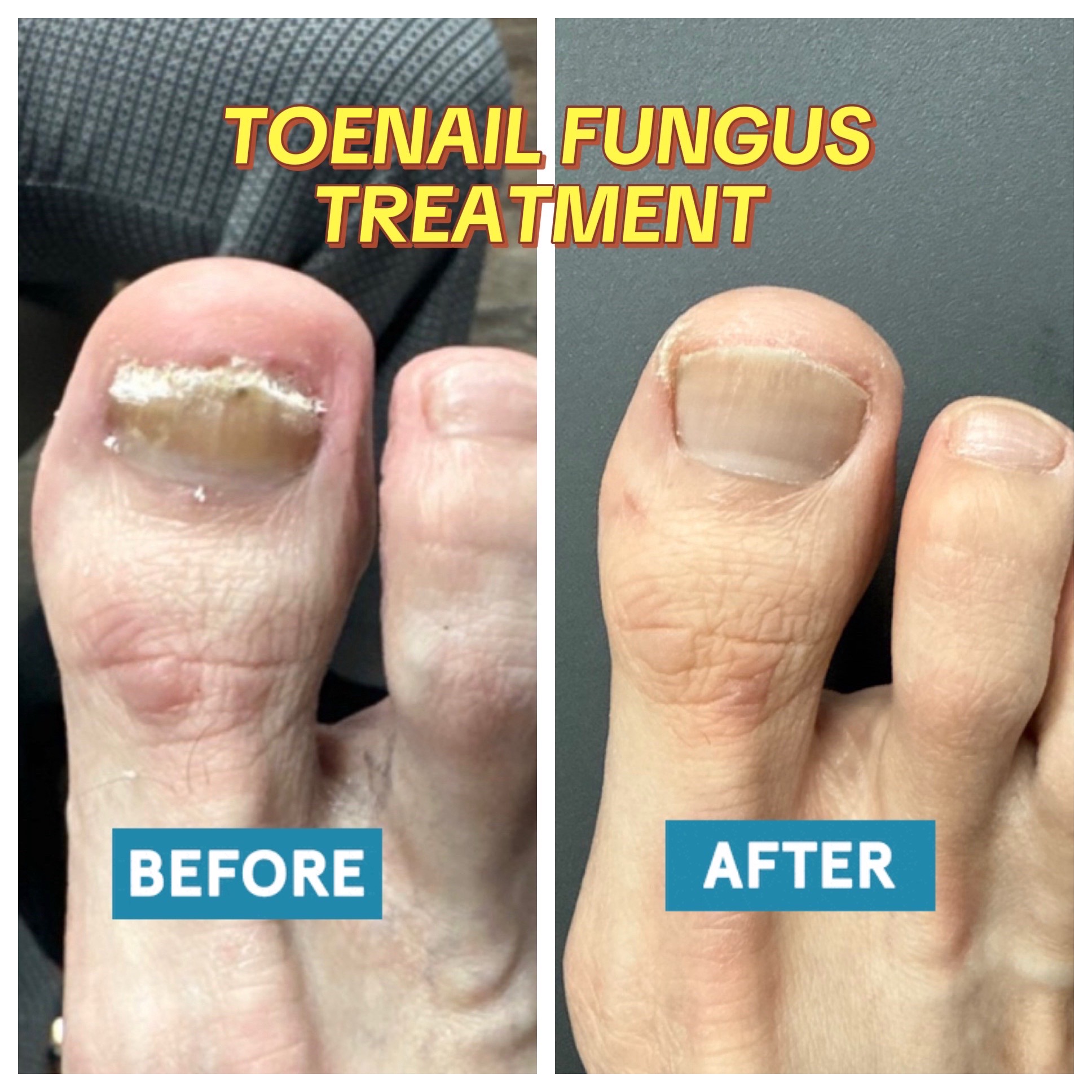 @Deniel Foot and Ankle Center