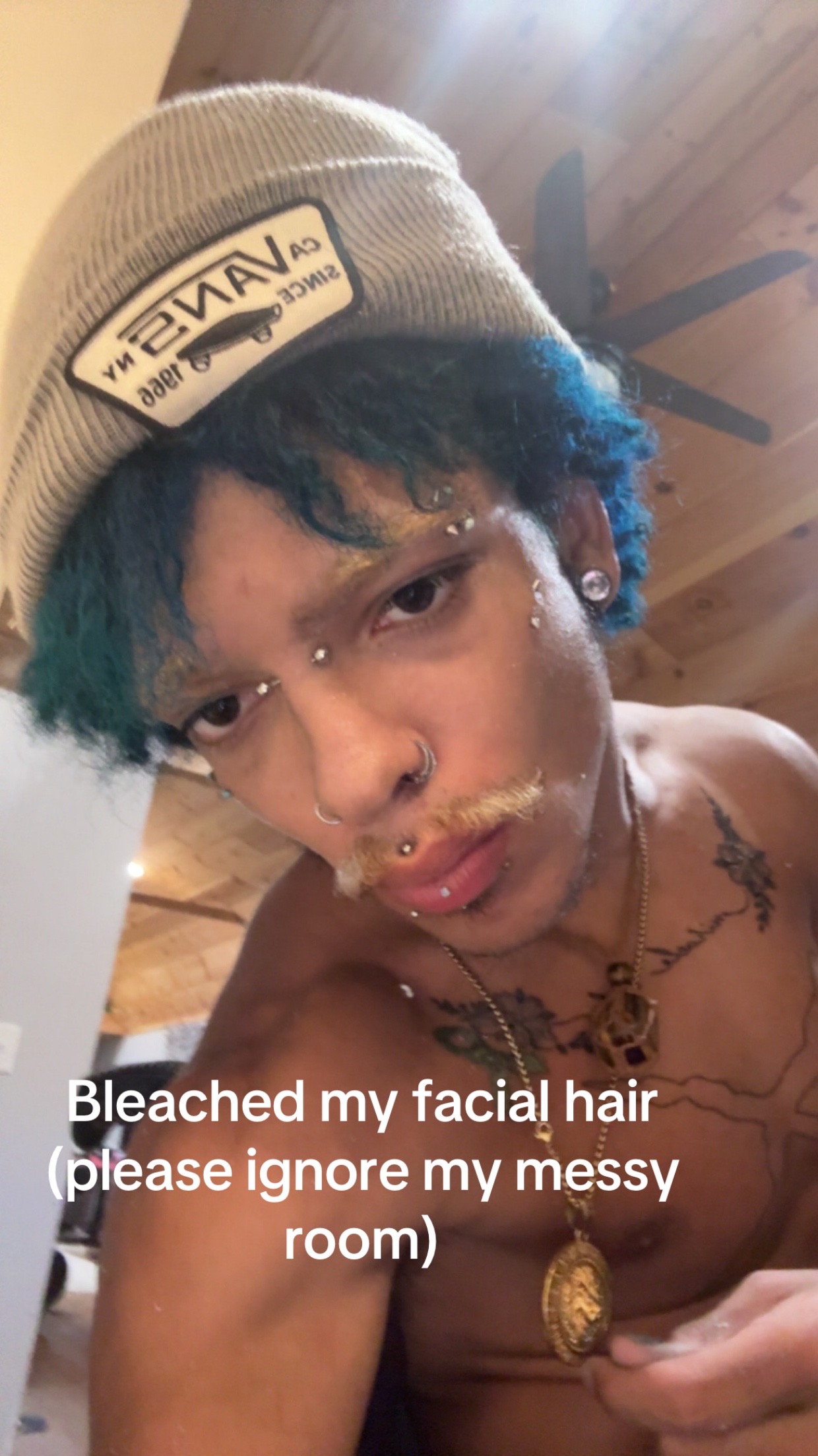 @Alt prince 🧑🏽🦽➡️
