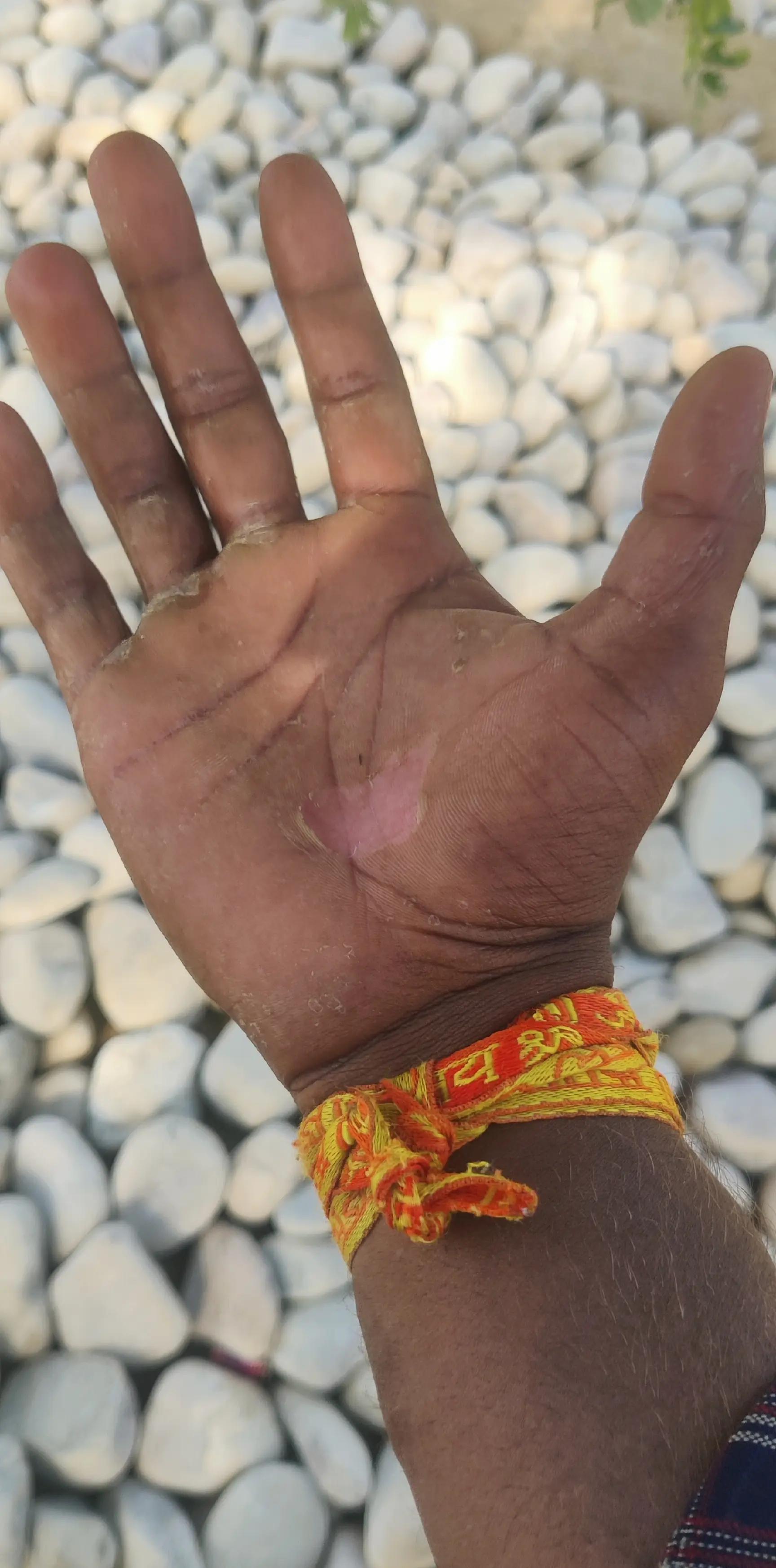 @sonchanking👑🥷🥷🇳🇵🔥