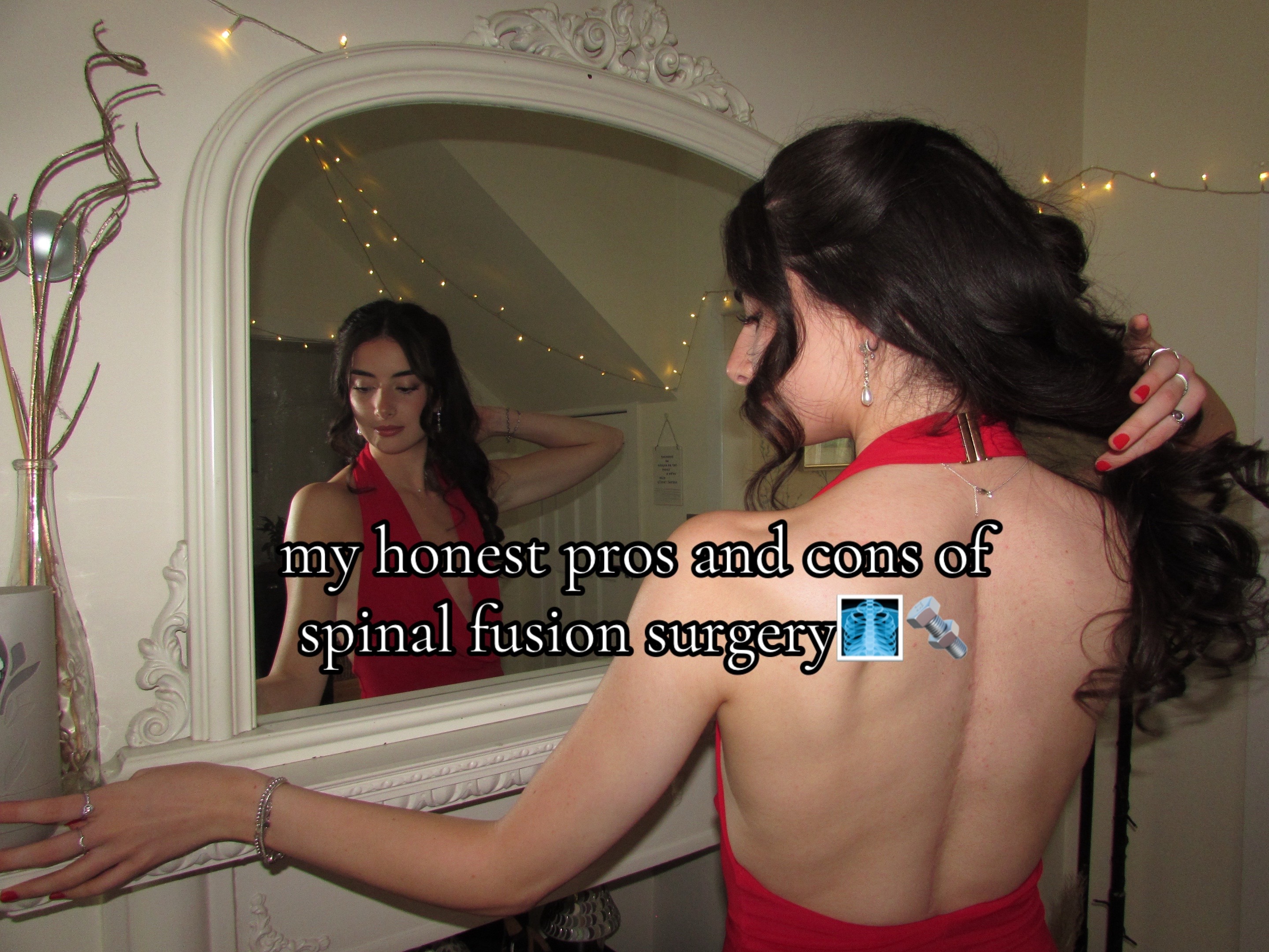 @ciaraxspinalfusion