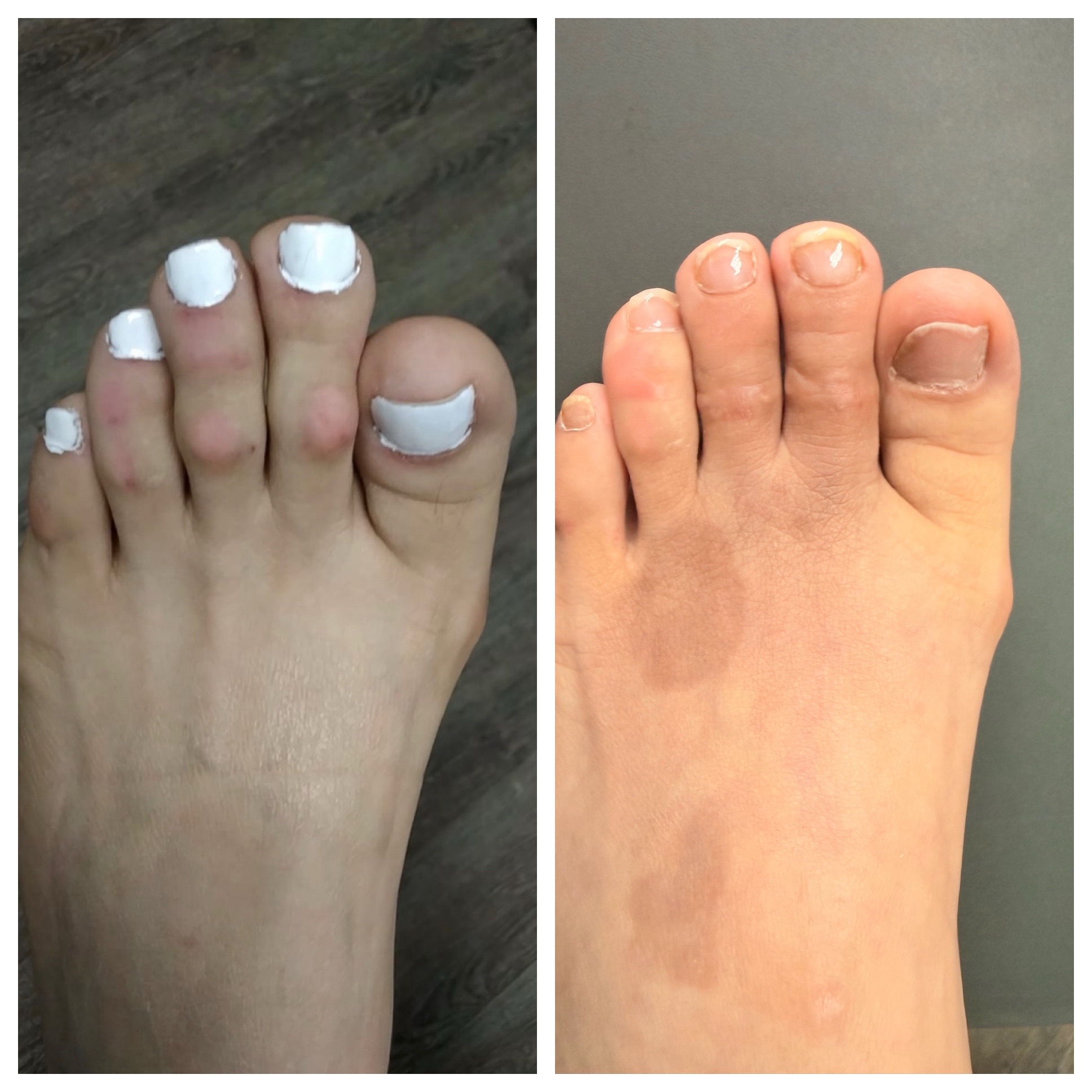 @Deniel Foot and Ankle Center