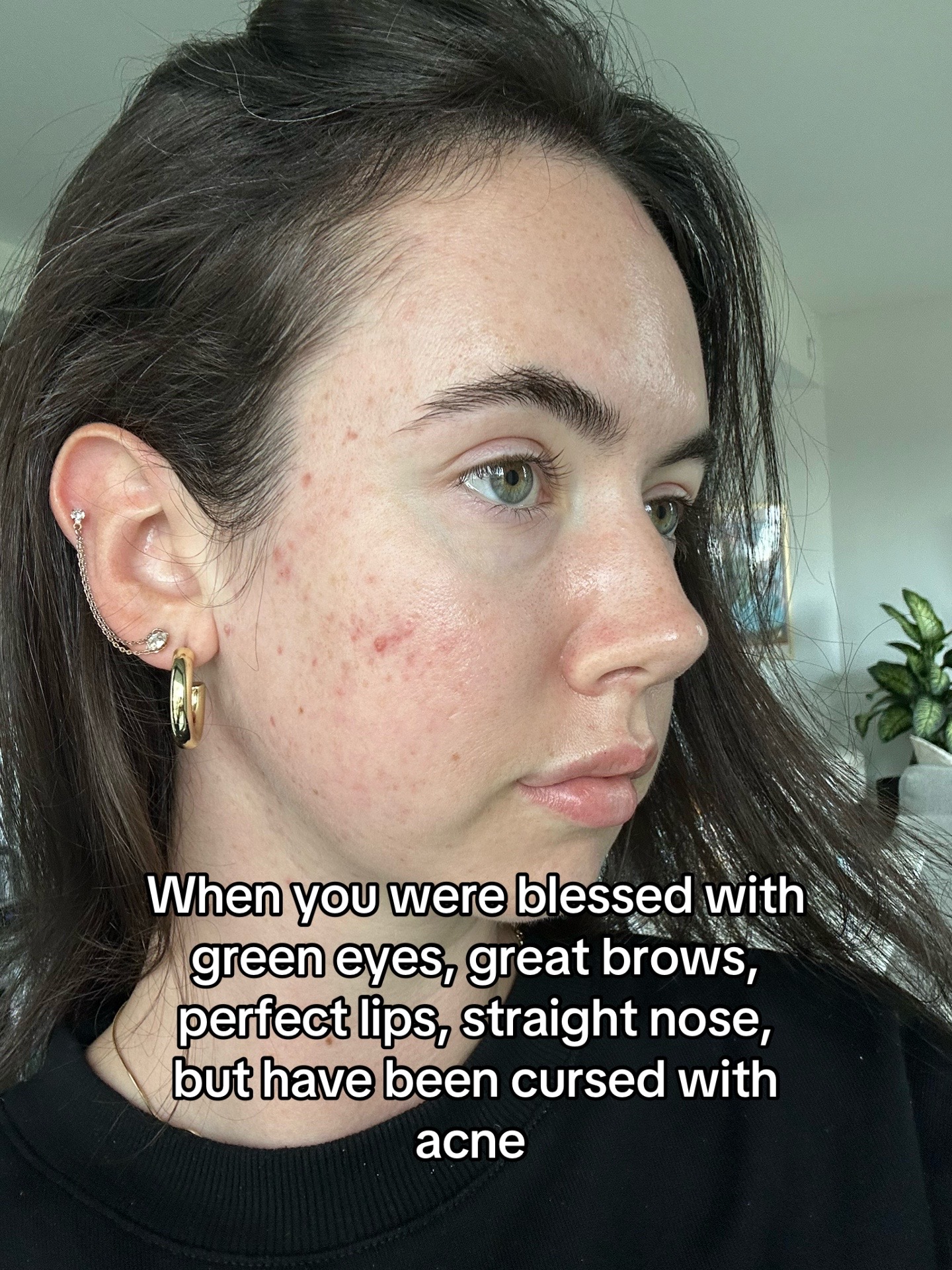 @Emlegs