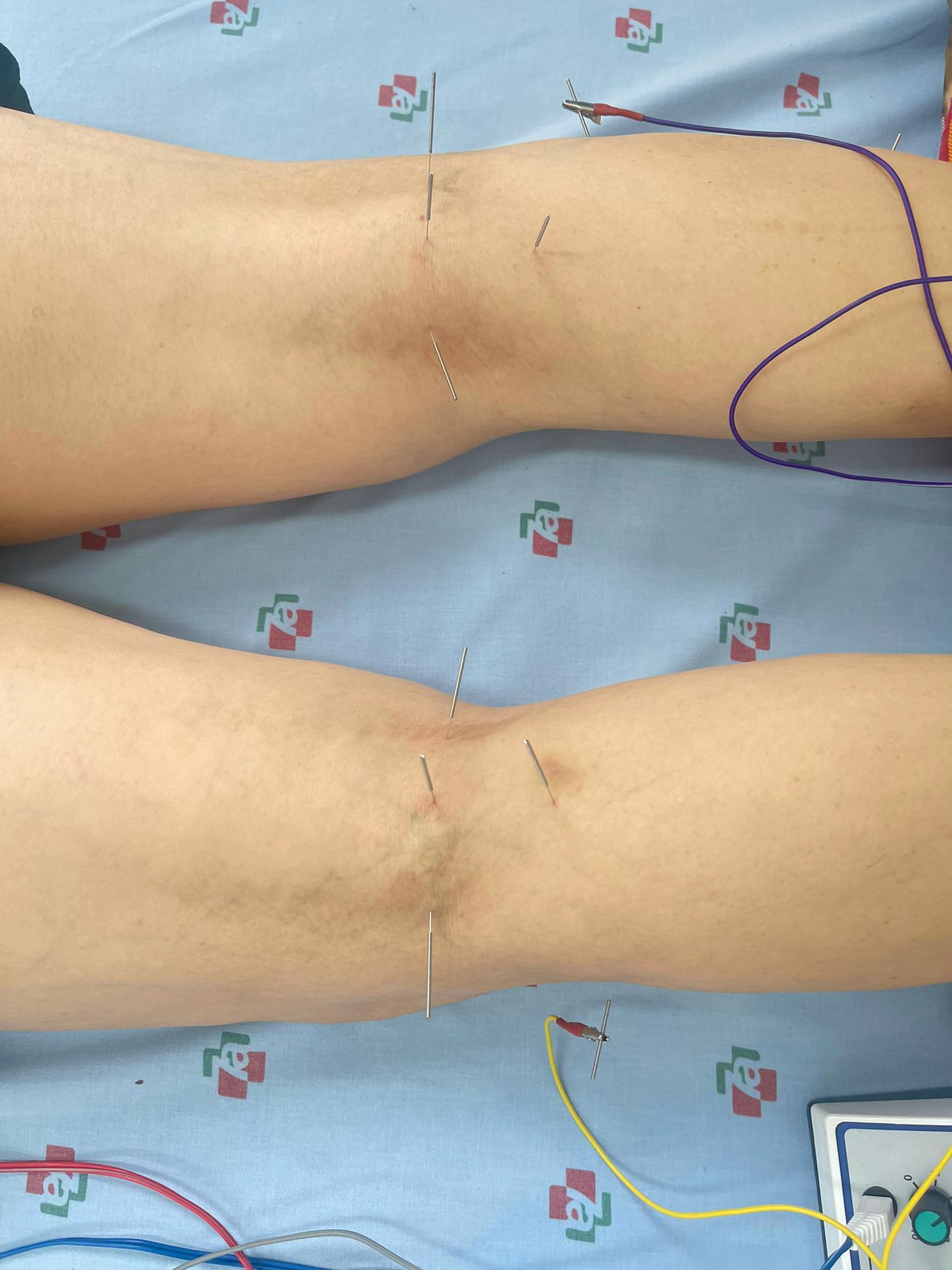 @Dr Nguyễn Hữu