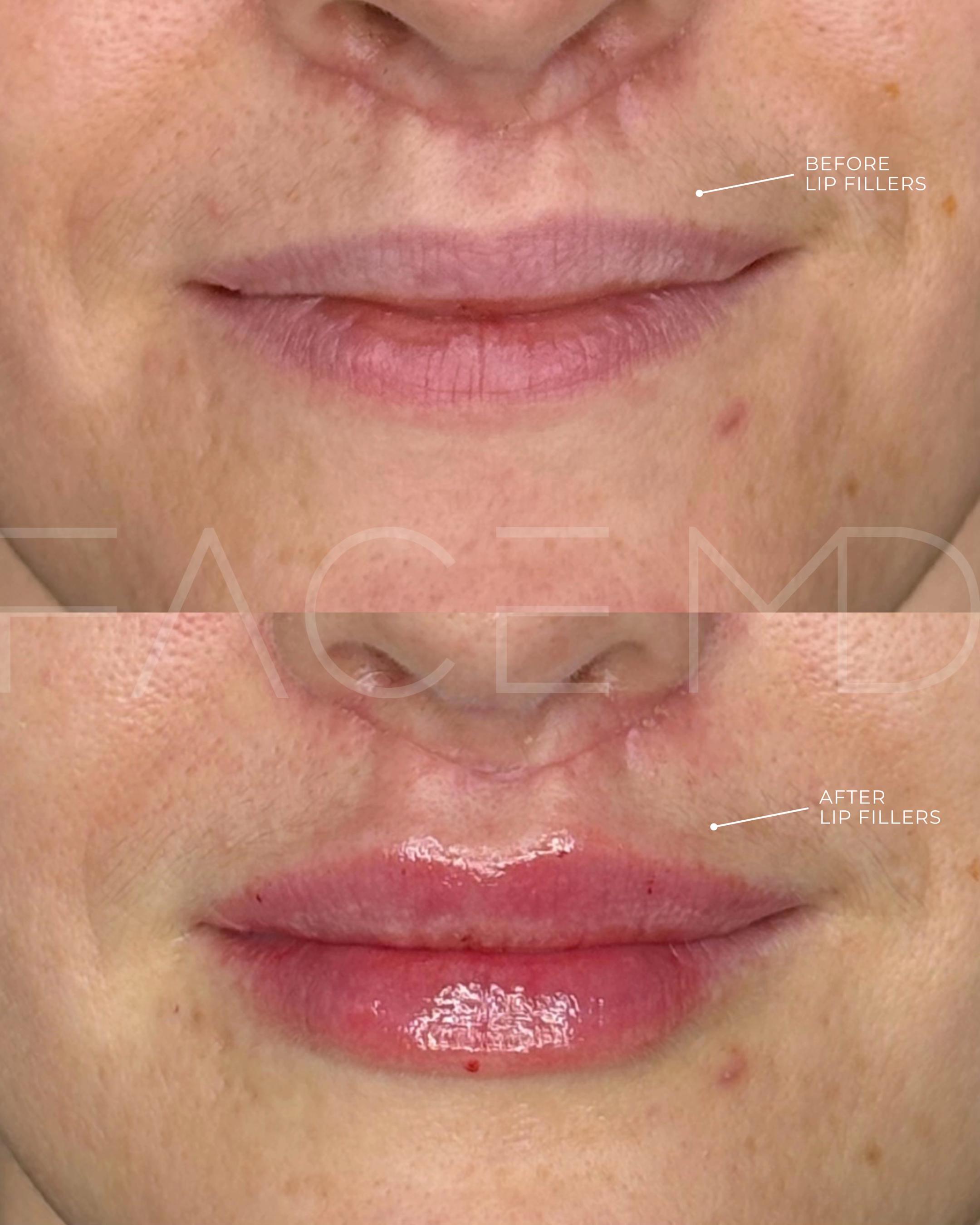 @cliniquefacemd