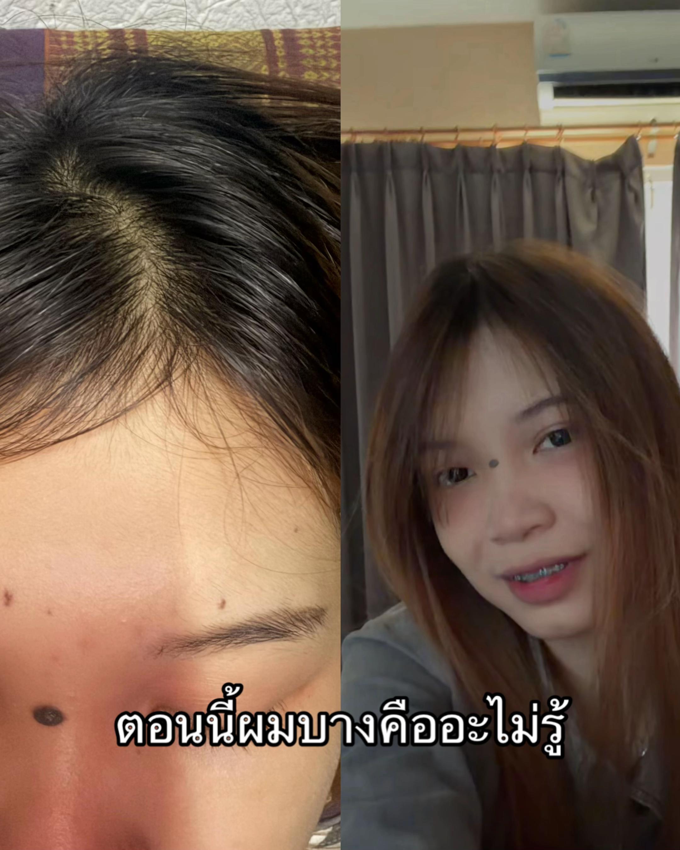 @ไอโอลีฟ