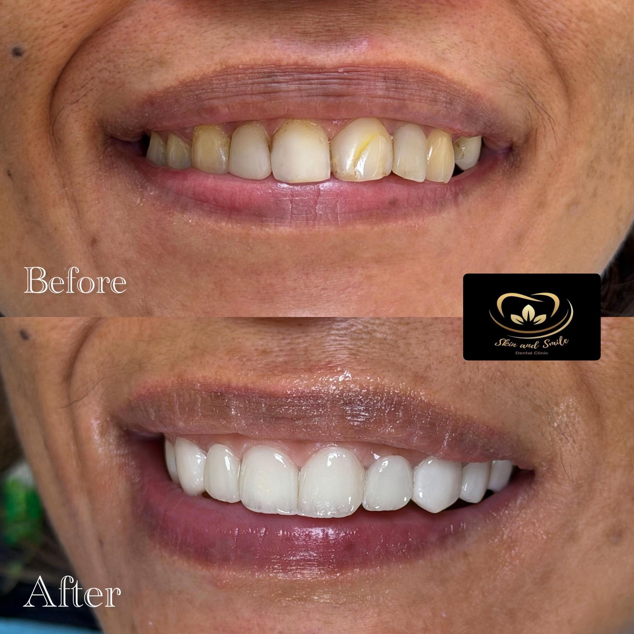 @SKIN AND SMILE DENTAL CLINIC