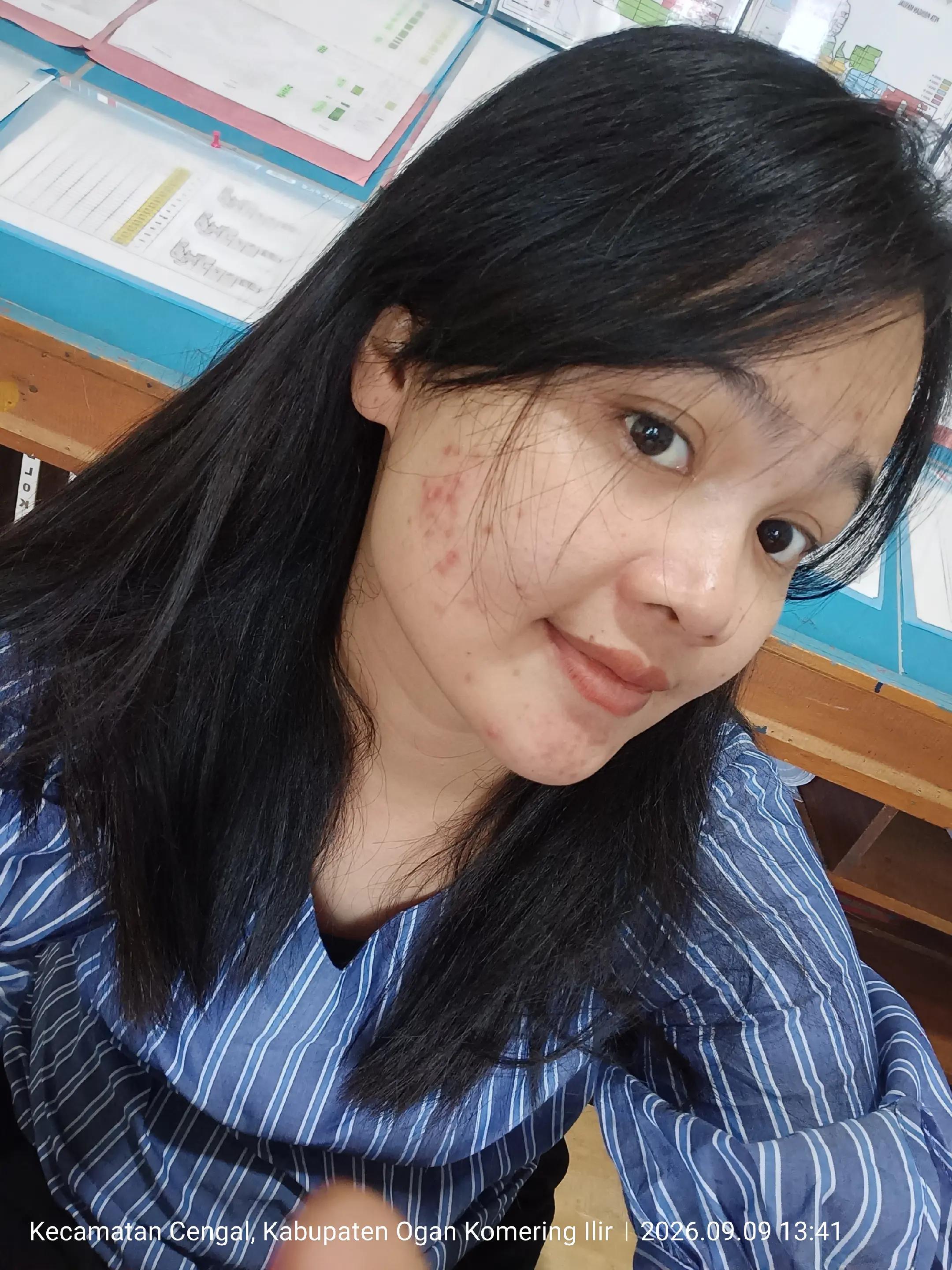 @Hani 🐜