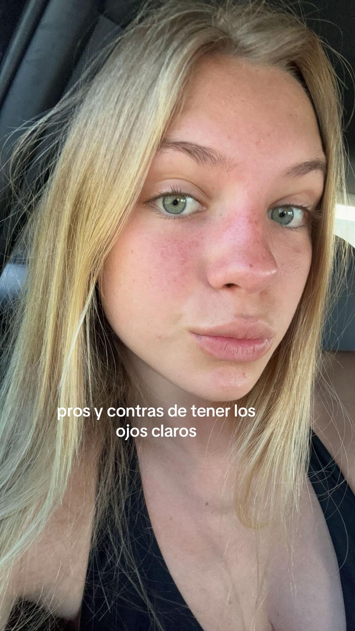 @lolamalgosa