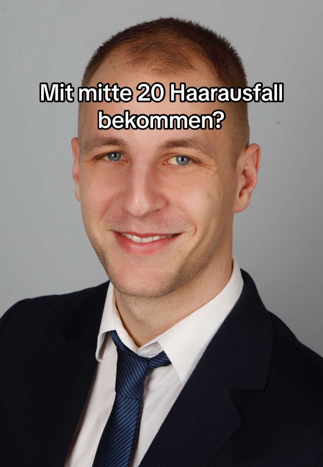 @Mr. Hairtransplant
