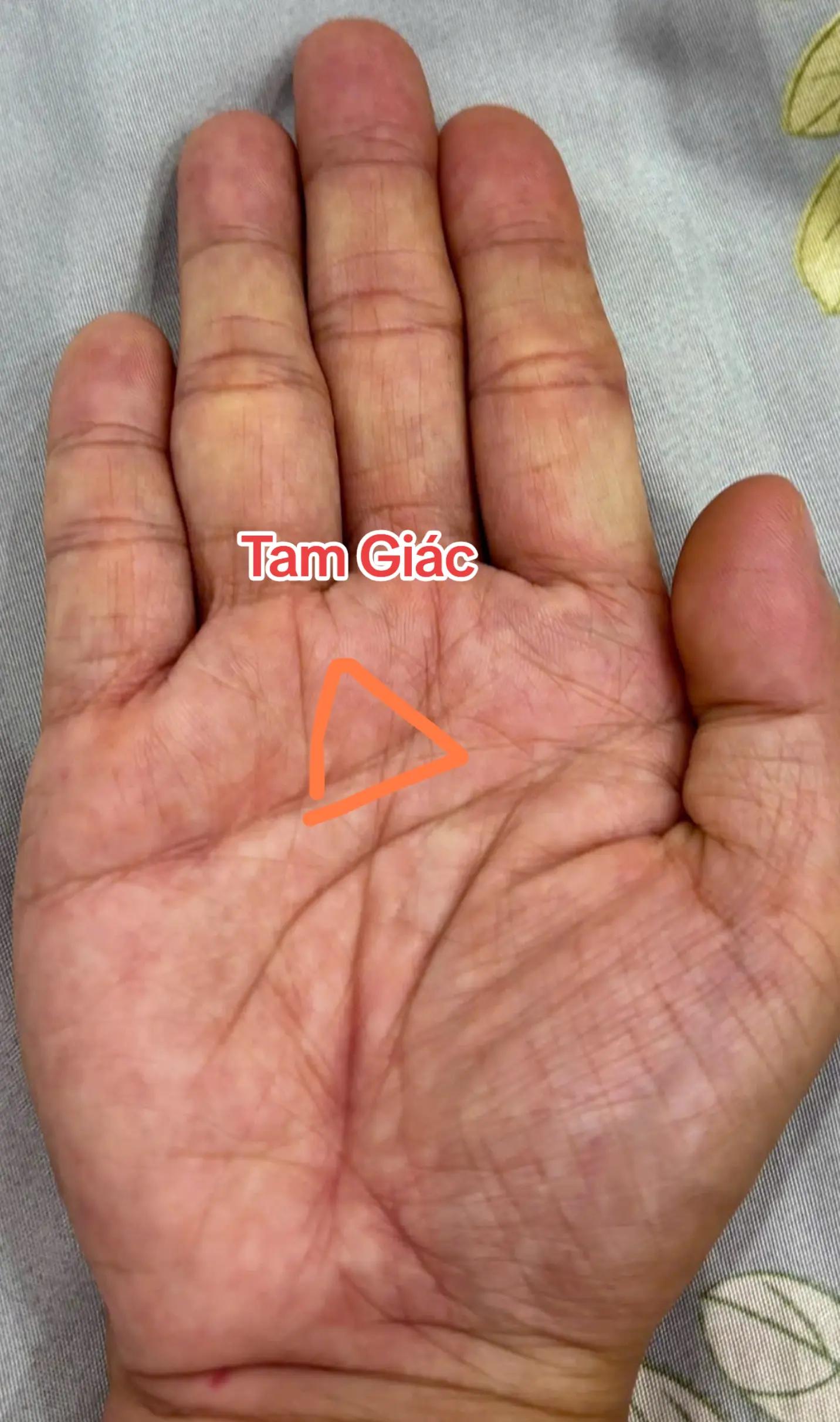 @Nh&acirc;n Tướng Sửa M&igrave;nh (Đỗ L&acirc;m)