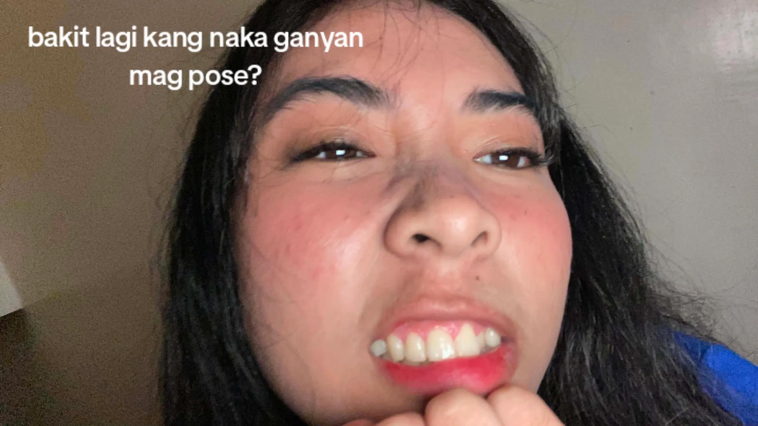 @franziee