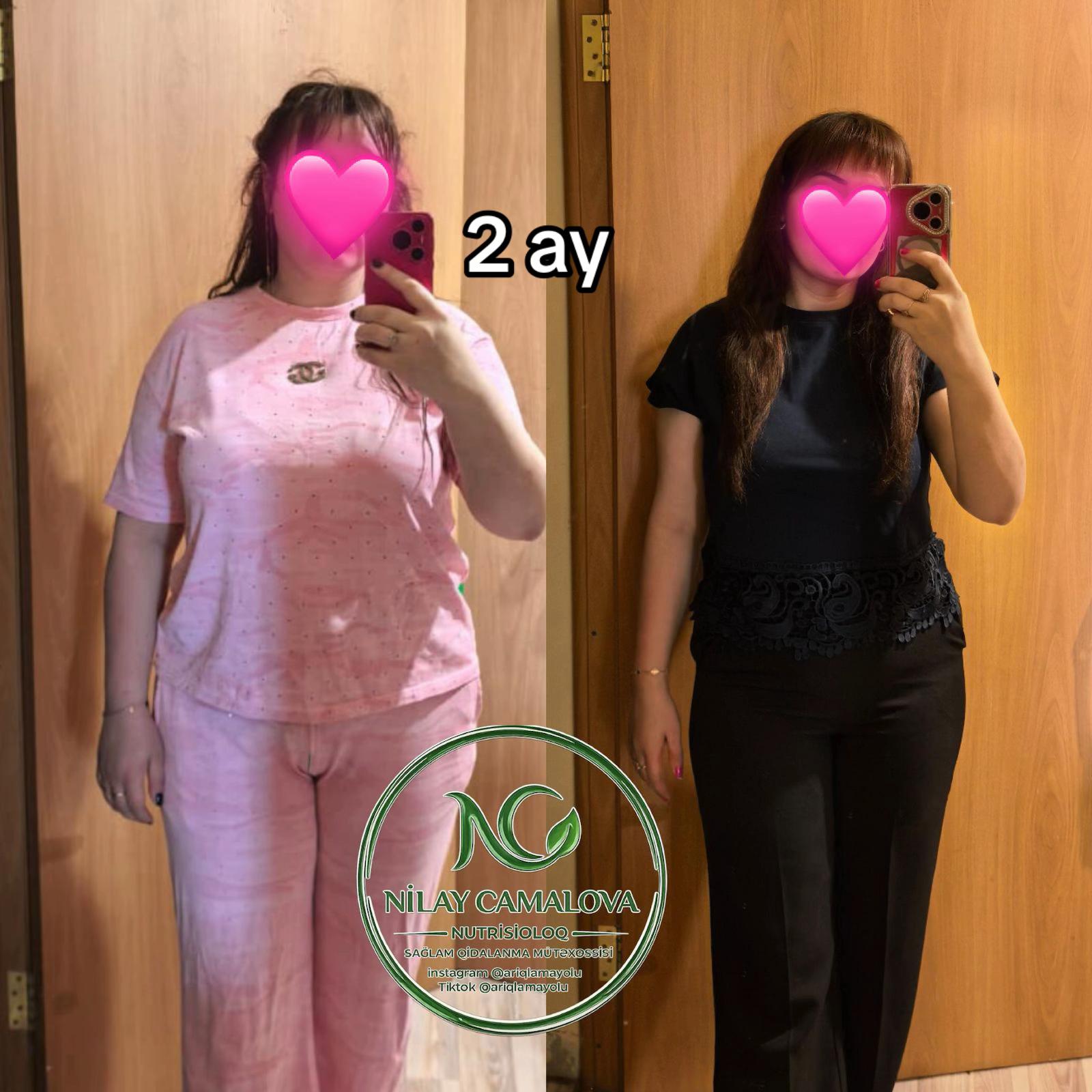 @Nutrisioloq Nilay Camalova 🥑