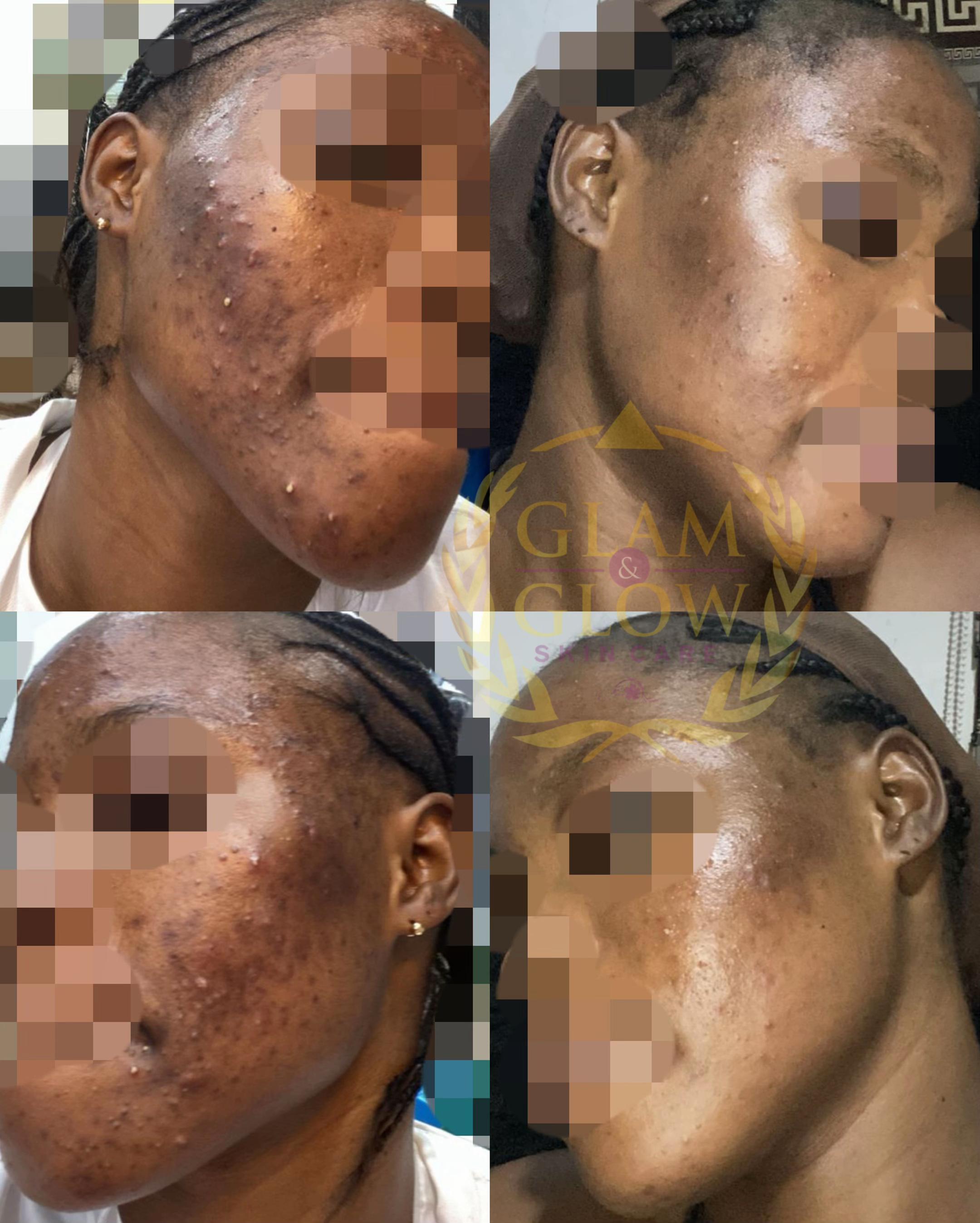 @SKIN REPAIR TREATMENT EXPERT