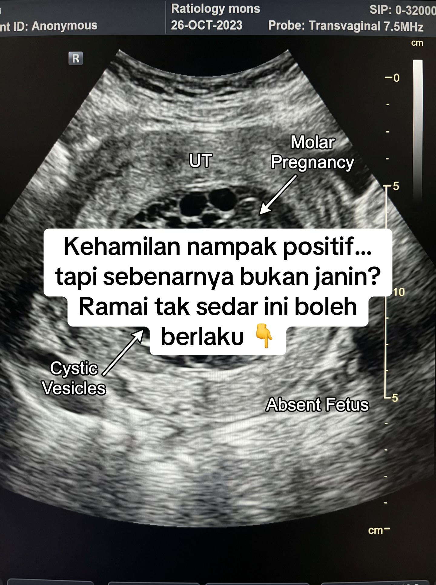 @effertymy