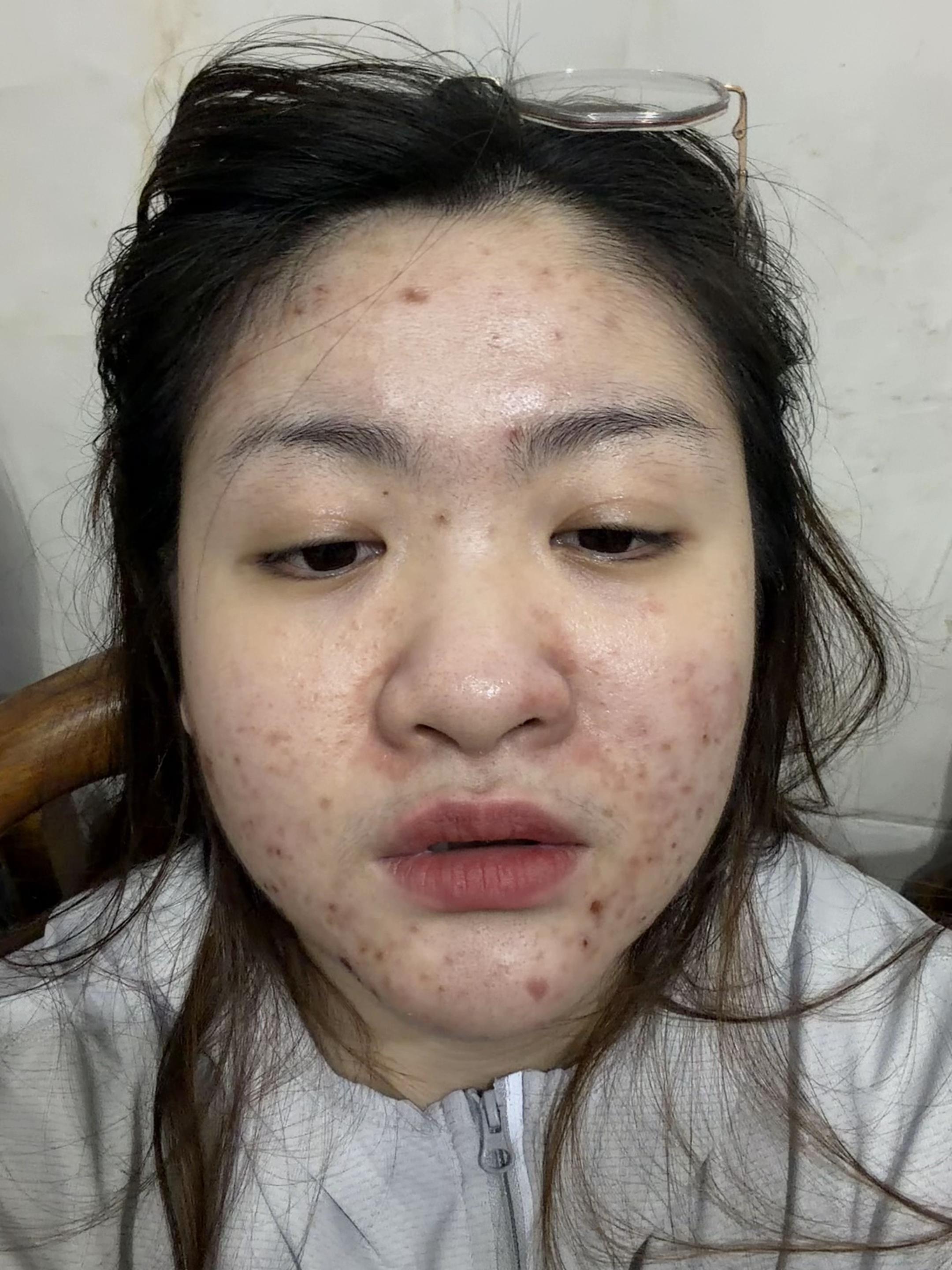 @Kimhong_H