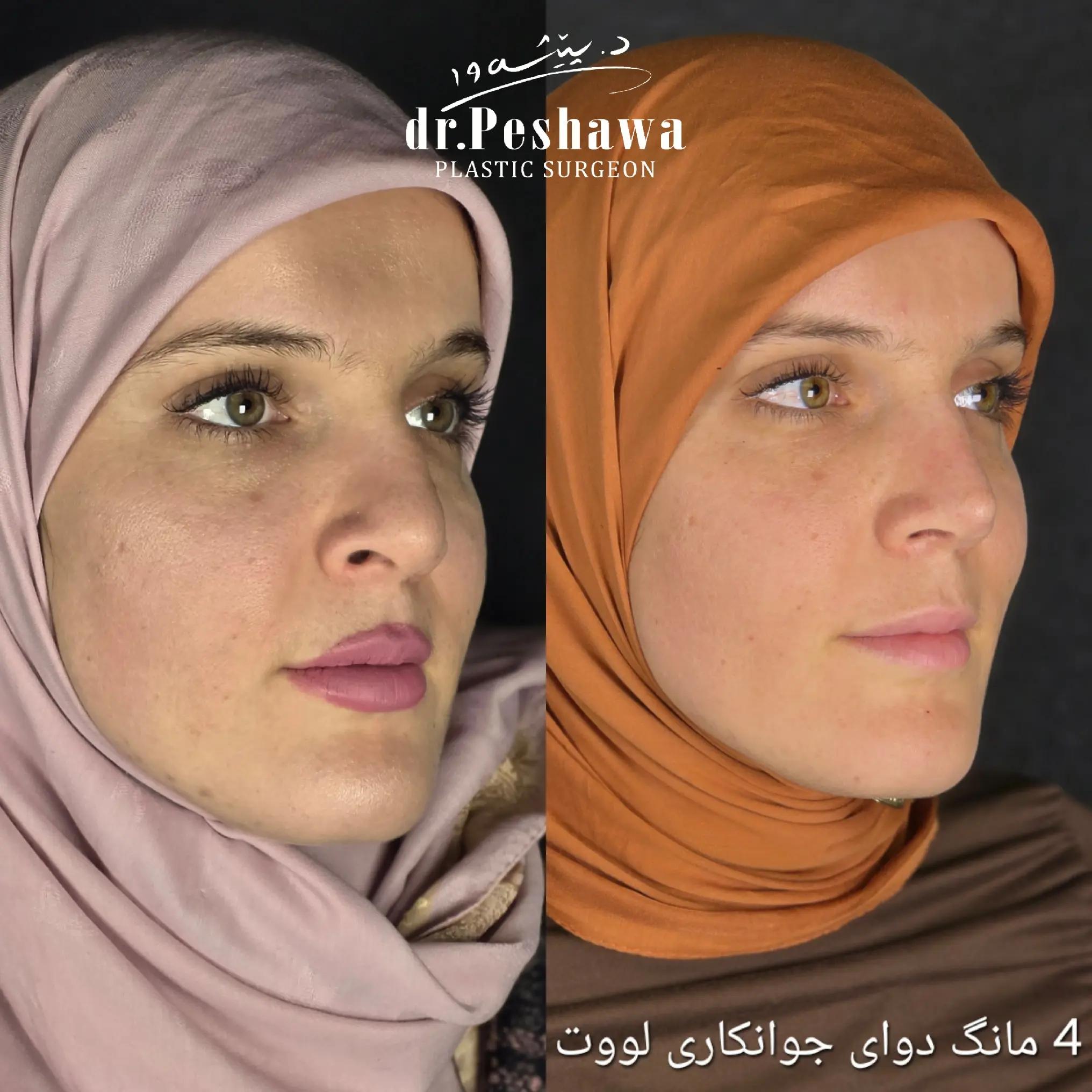 @Dr. Peshawa Plastic Surgeon