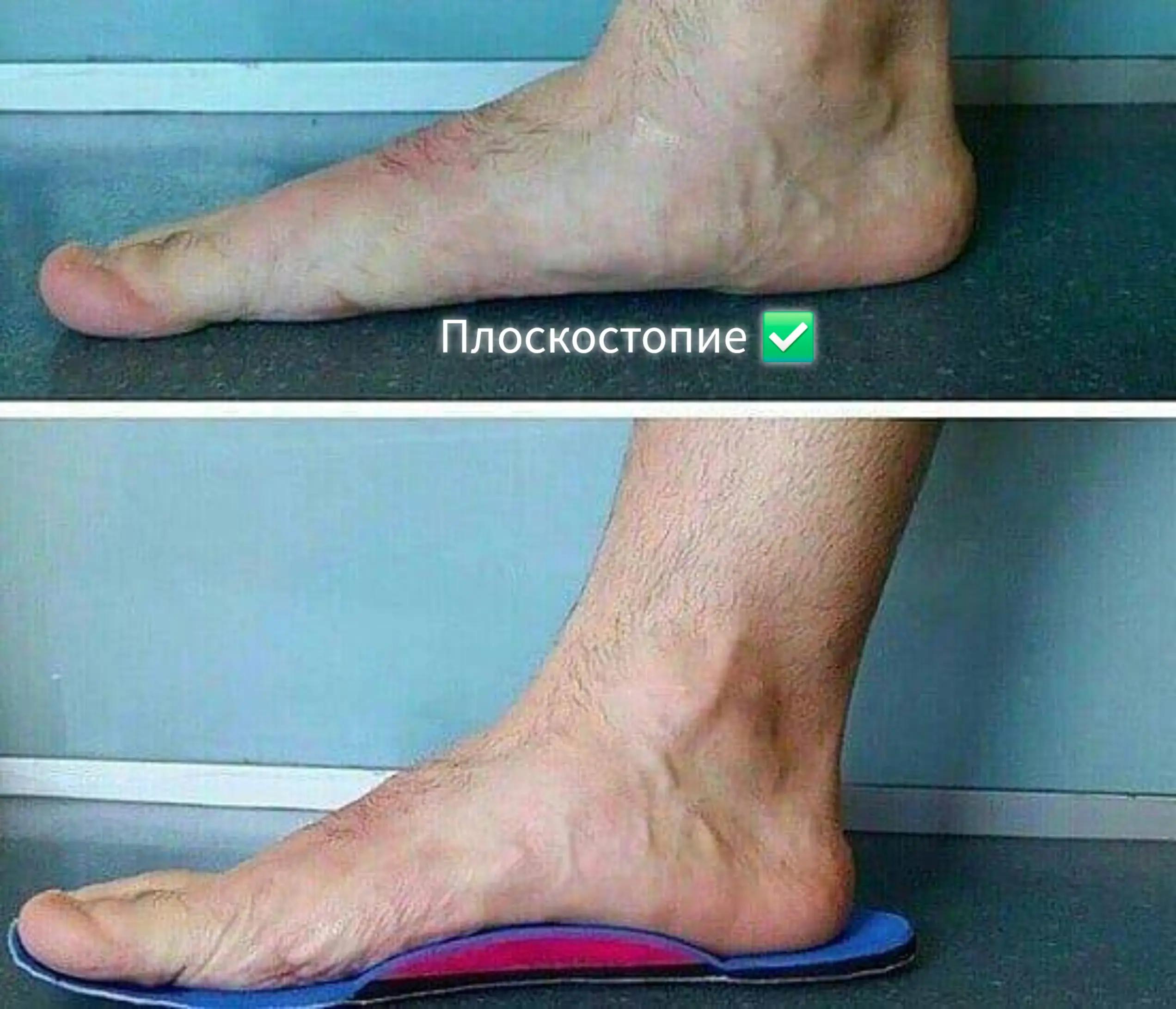 @Здоровый позвоночник♡Юж.Корея