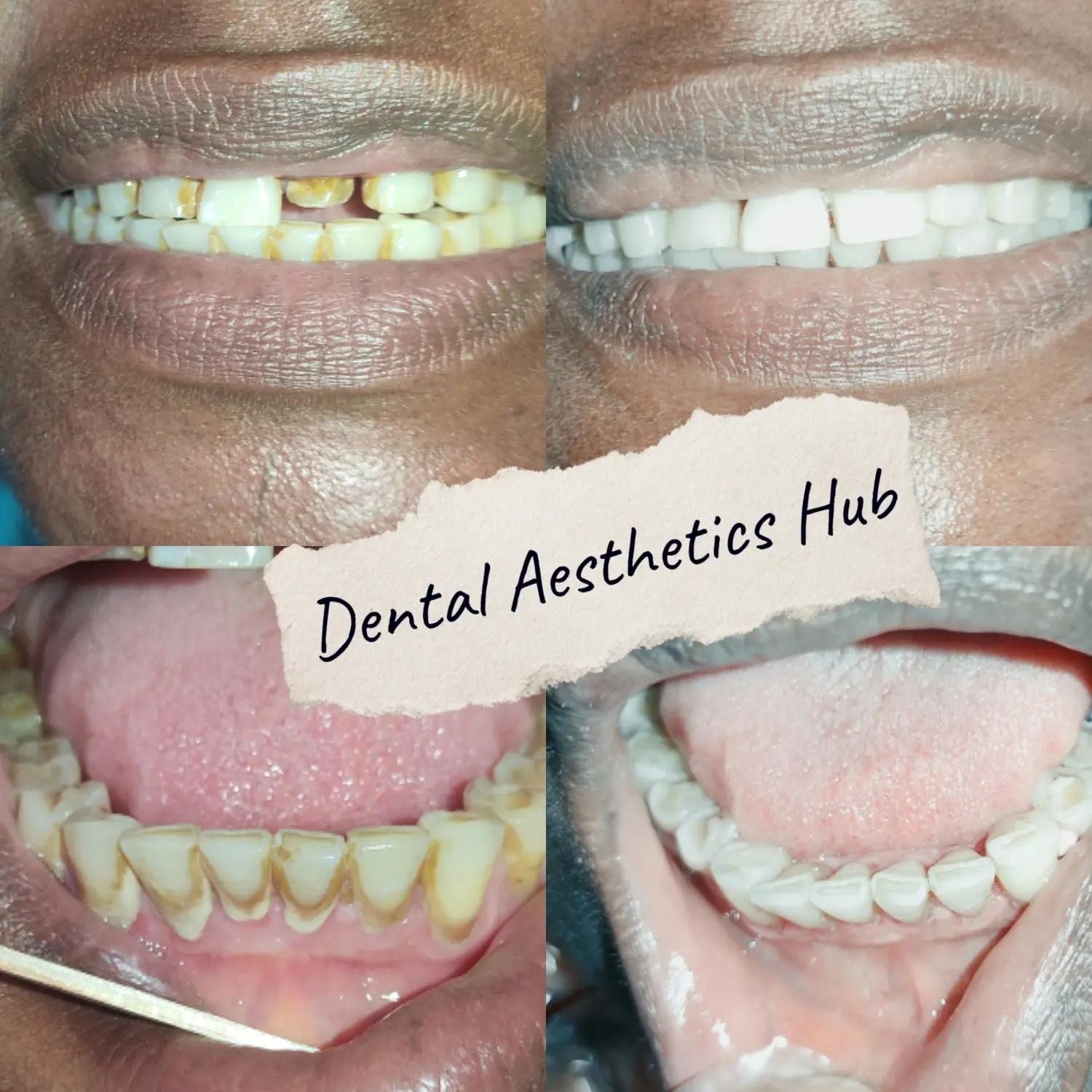 @O&sup2;V Dental Aesthetics Hub🦷