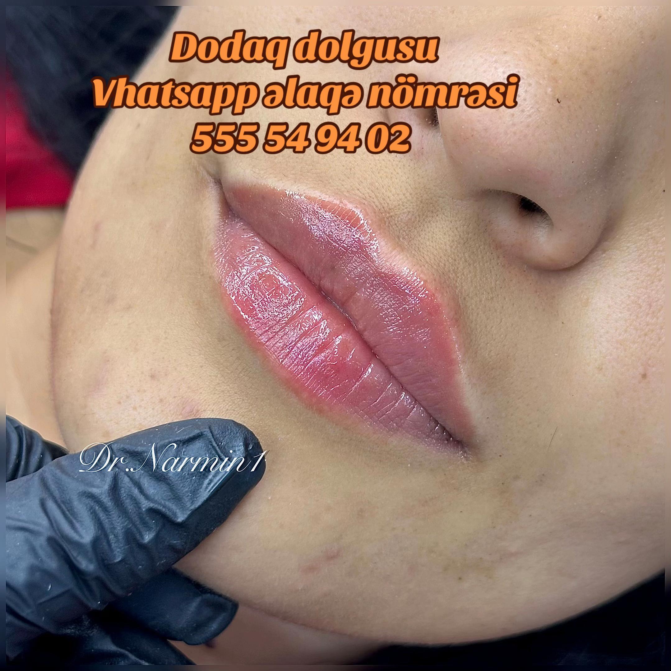 @Pm.N_permanent.marneuli