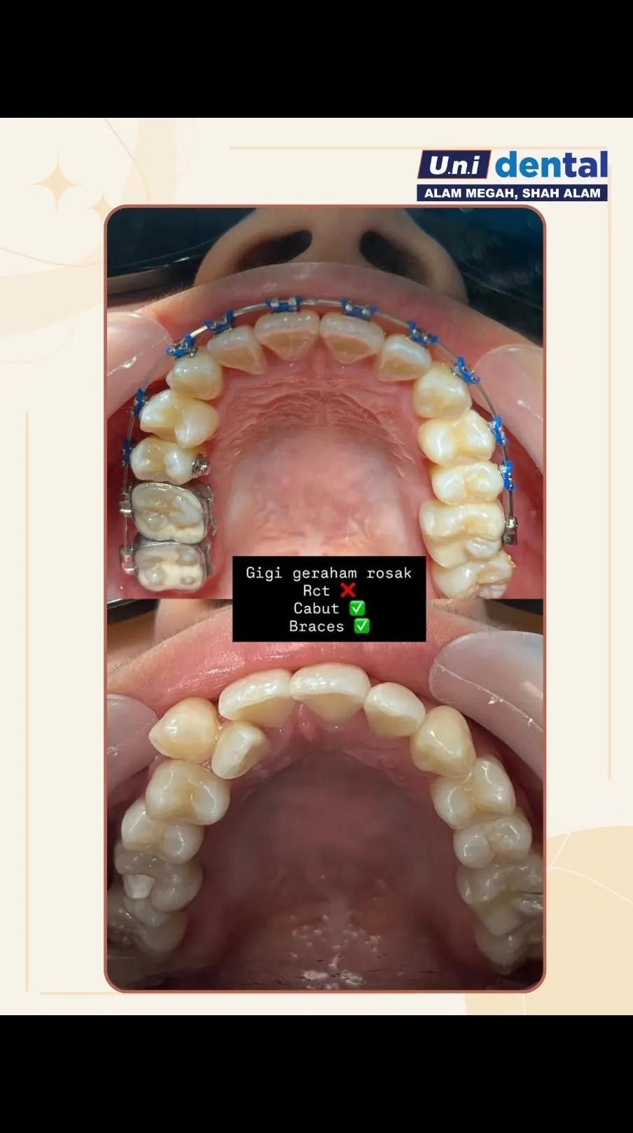 @Klinik UNI Dental Alam Megah