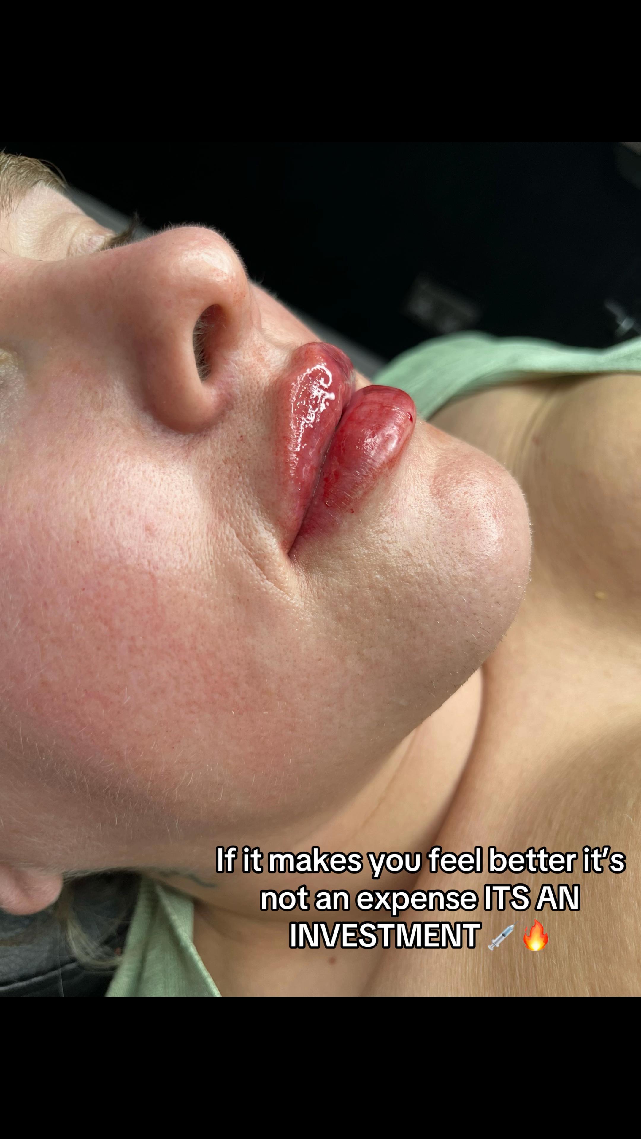 @Superfacial Aesthetics