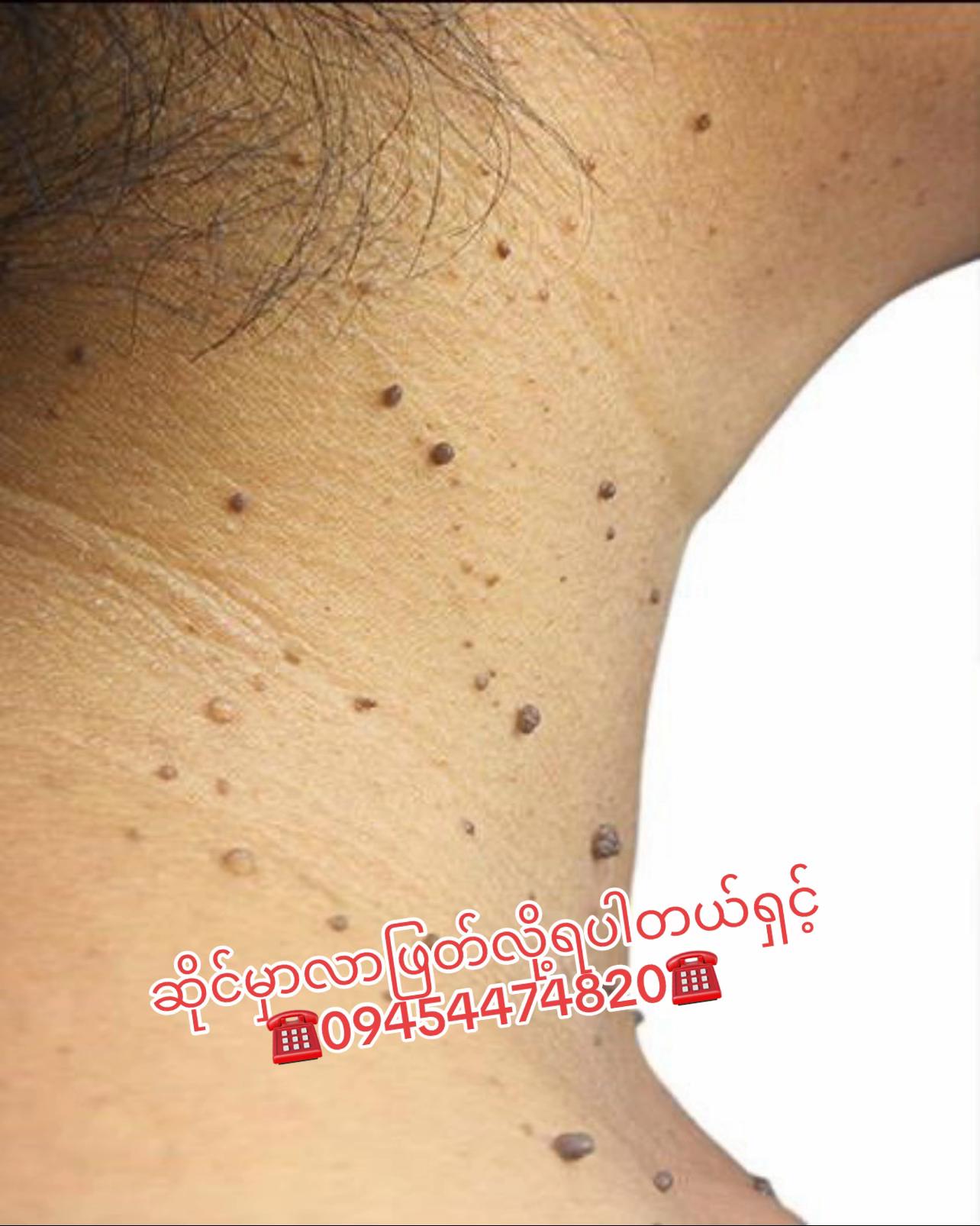 @JaJa (April Nu Beauty Clinic)