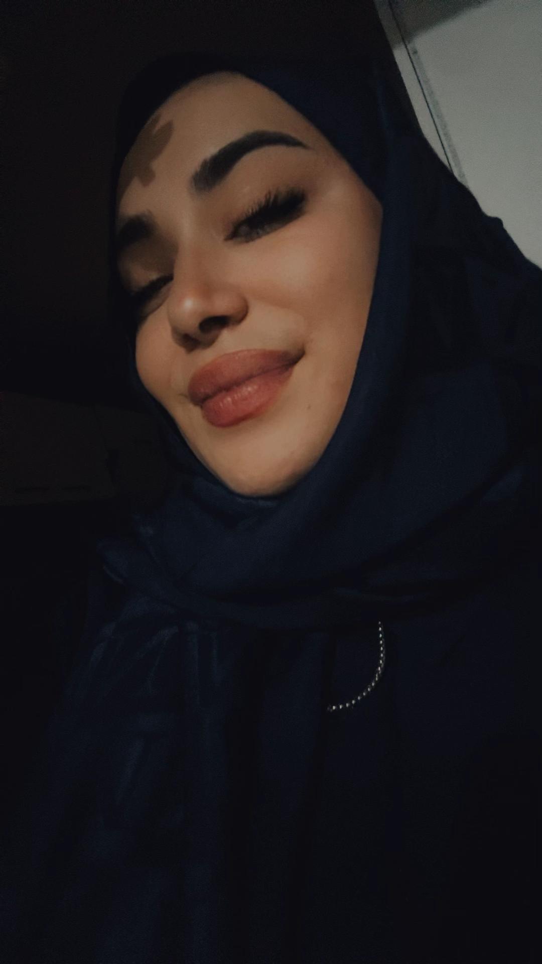 @Buket yıldırım