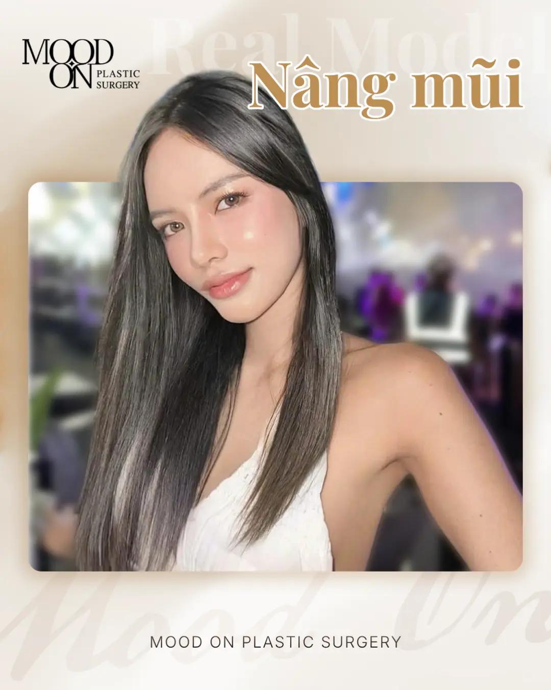 @Bệnh viện thẩm mỹ Mood On