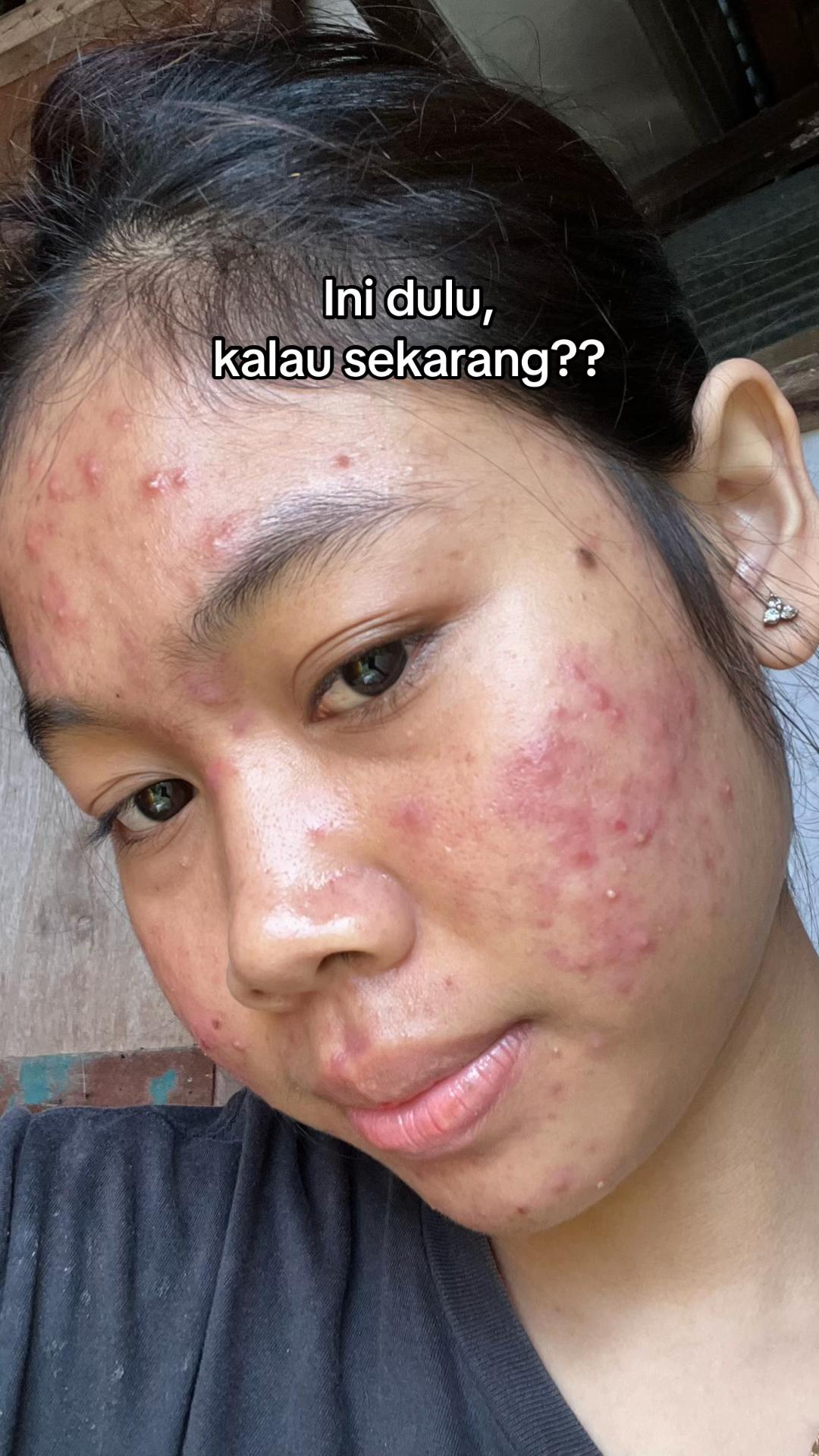 @Nina Marselina