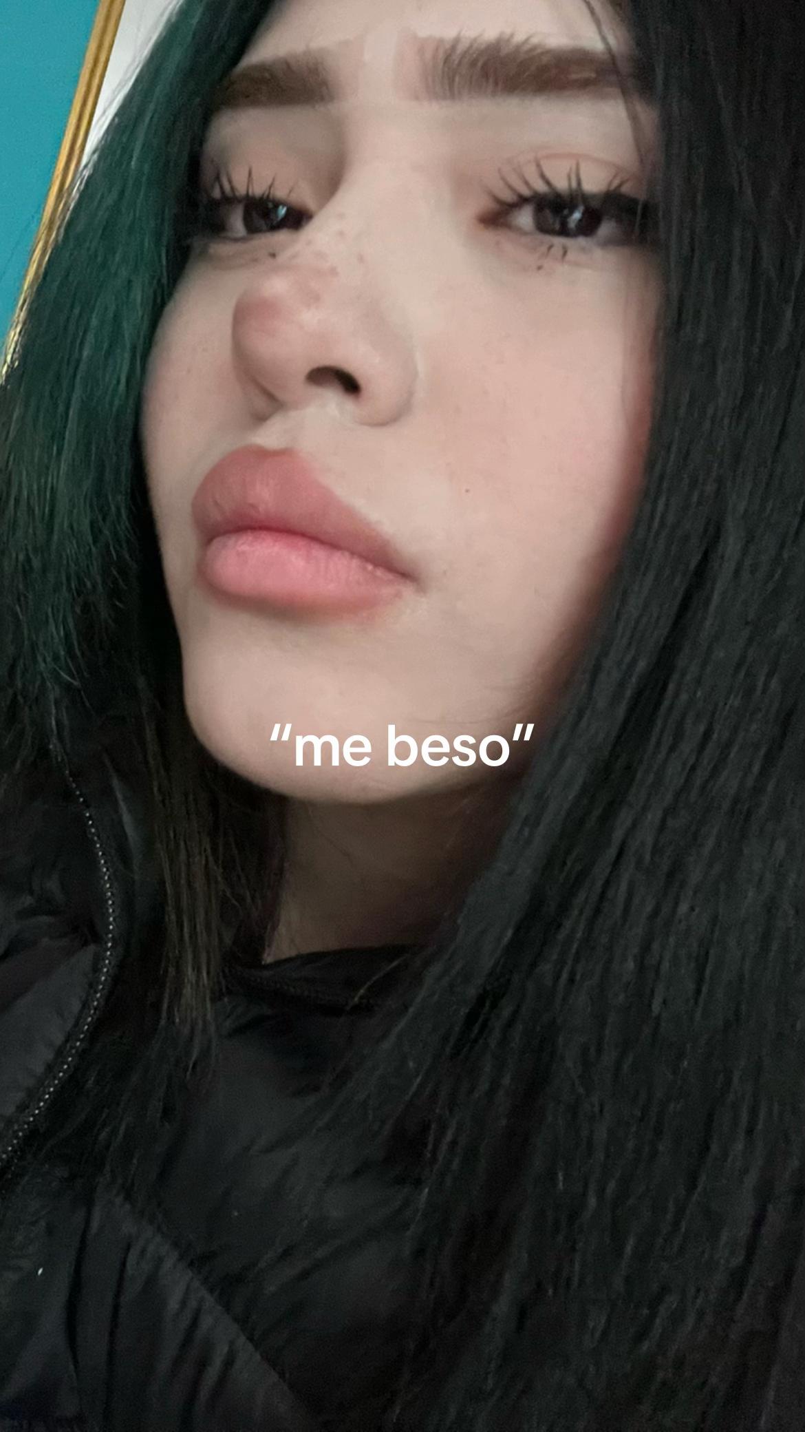 @𝐀𝐥𝐢𝐩𝐫𝐨 🍓