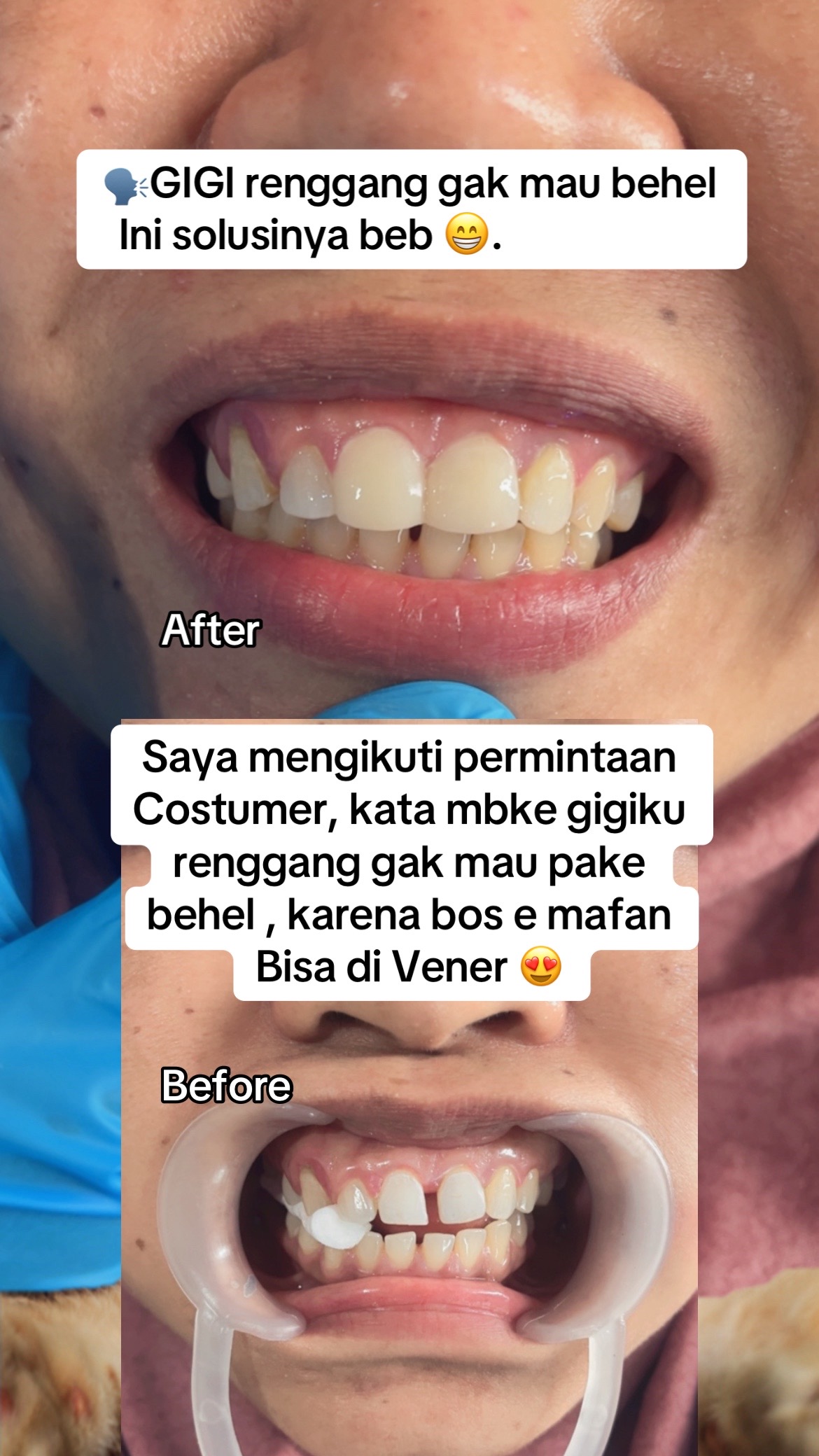 @mbak-Paijem