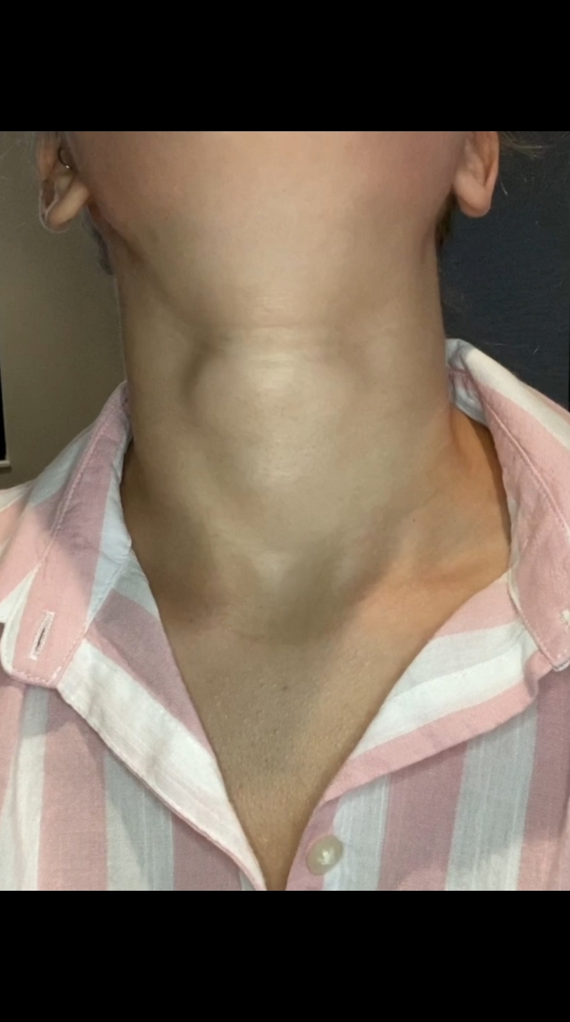 @the_female_neck.v5