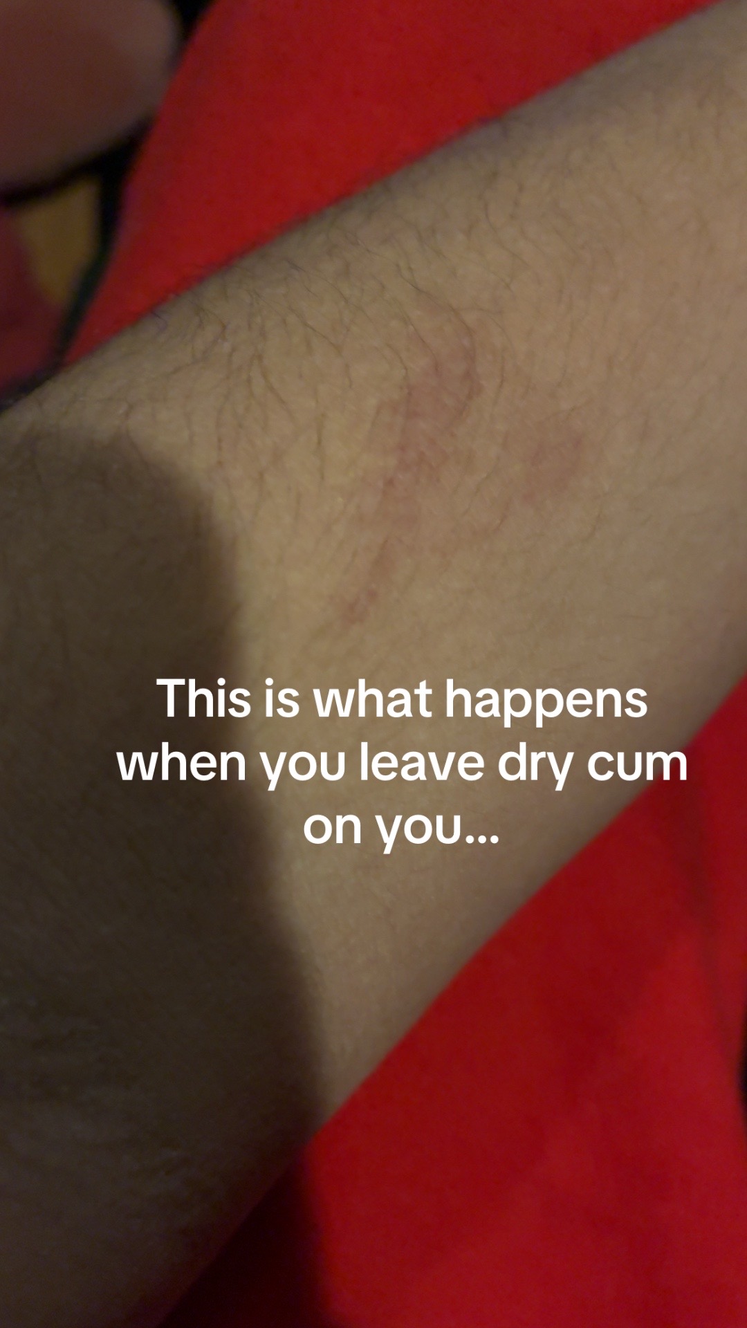 @burr640