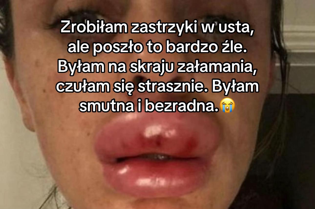 @Supreme Lips PL 🫦