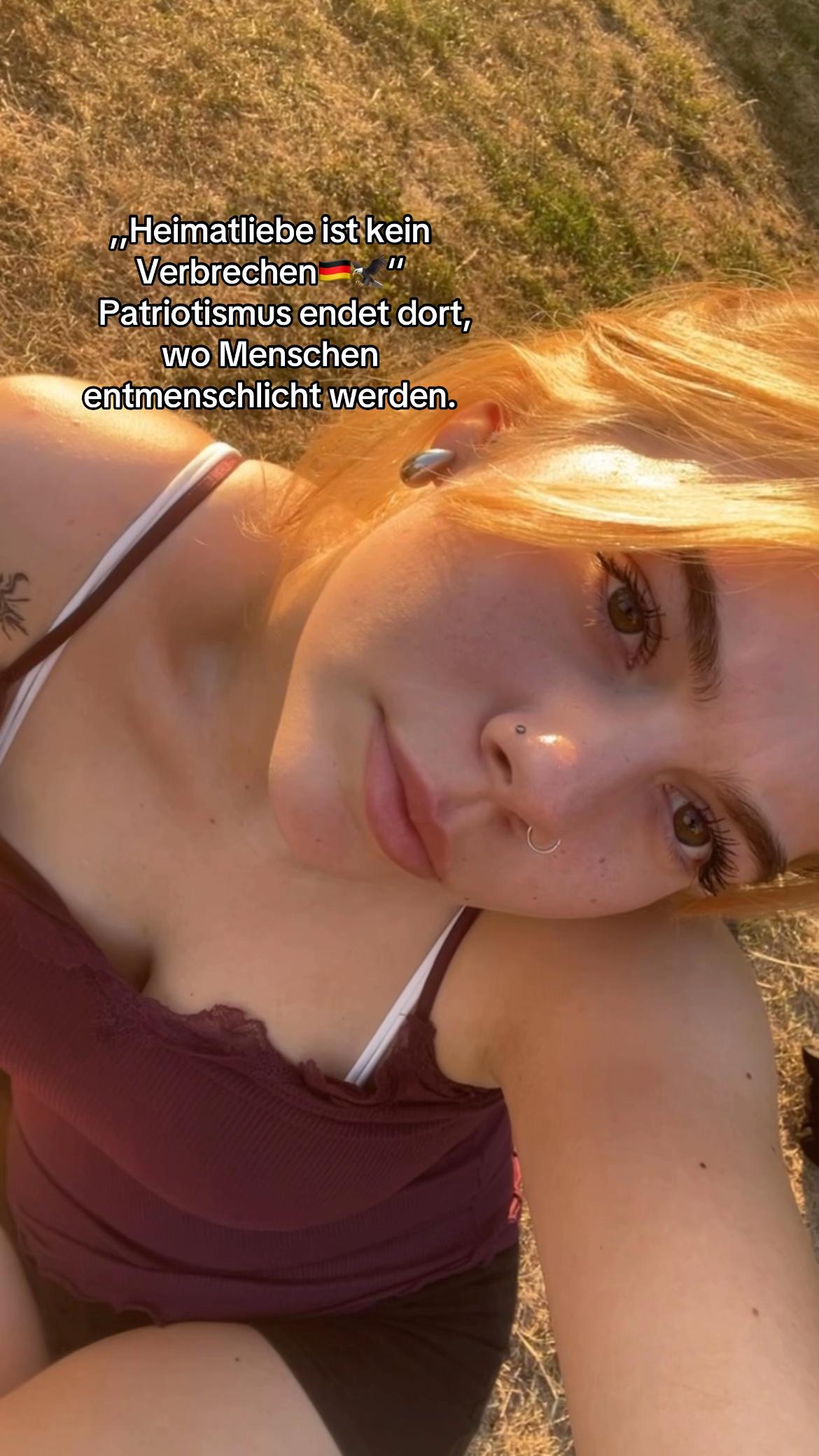 @161