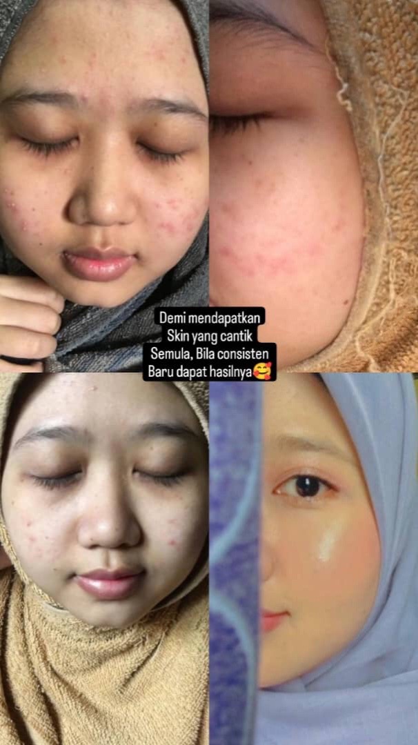 @AINAANIDA