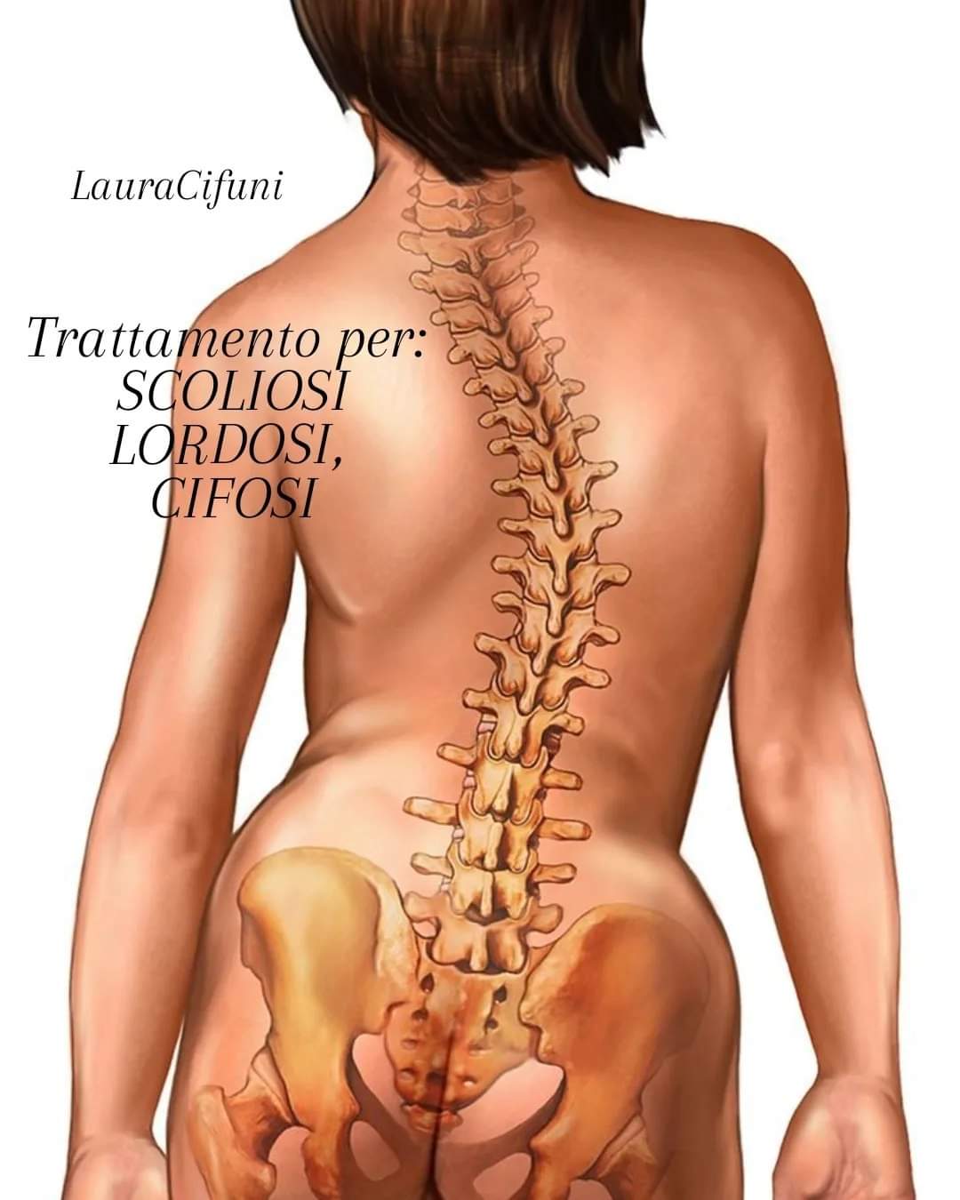 @LauraCifuni