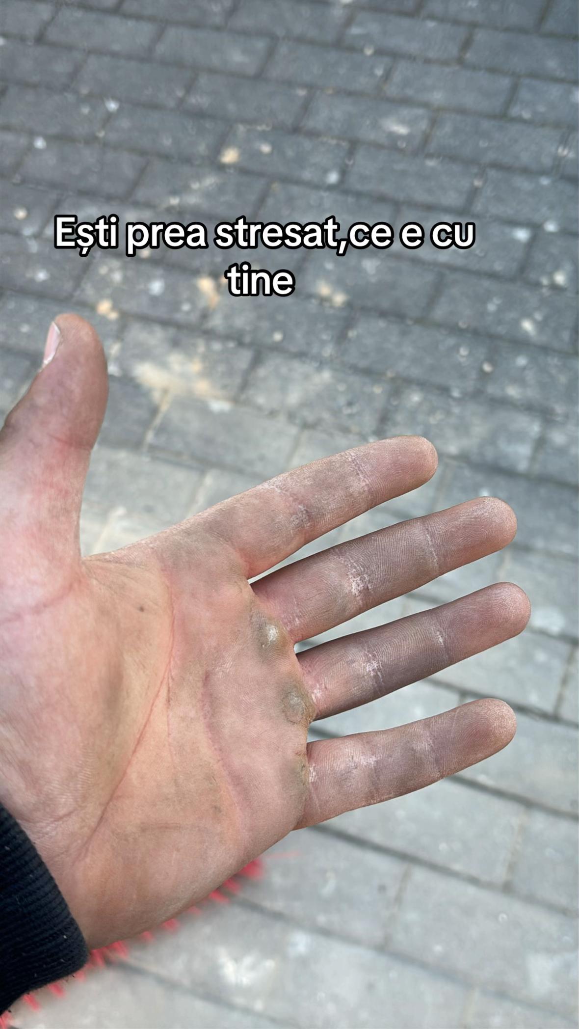 @🇦🇱