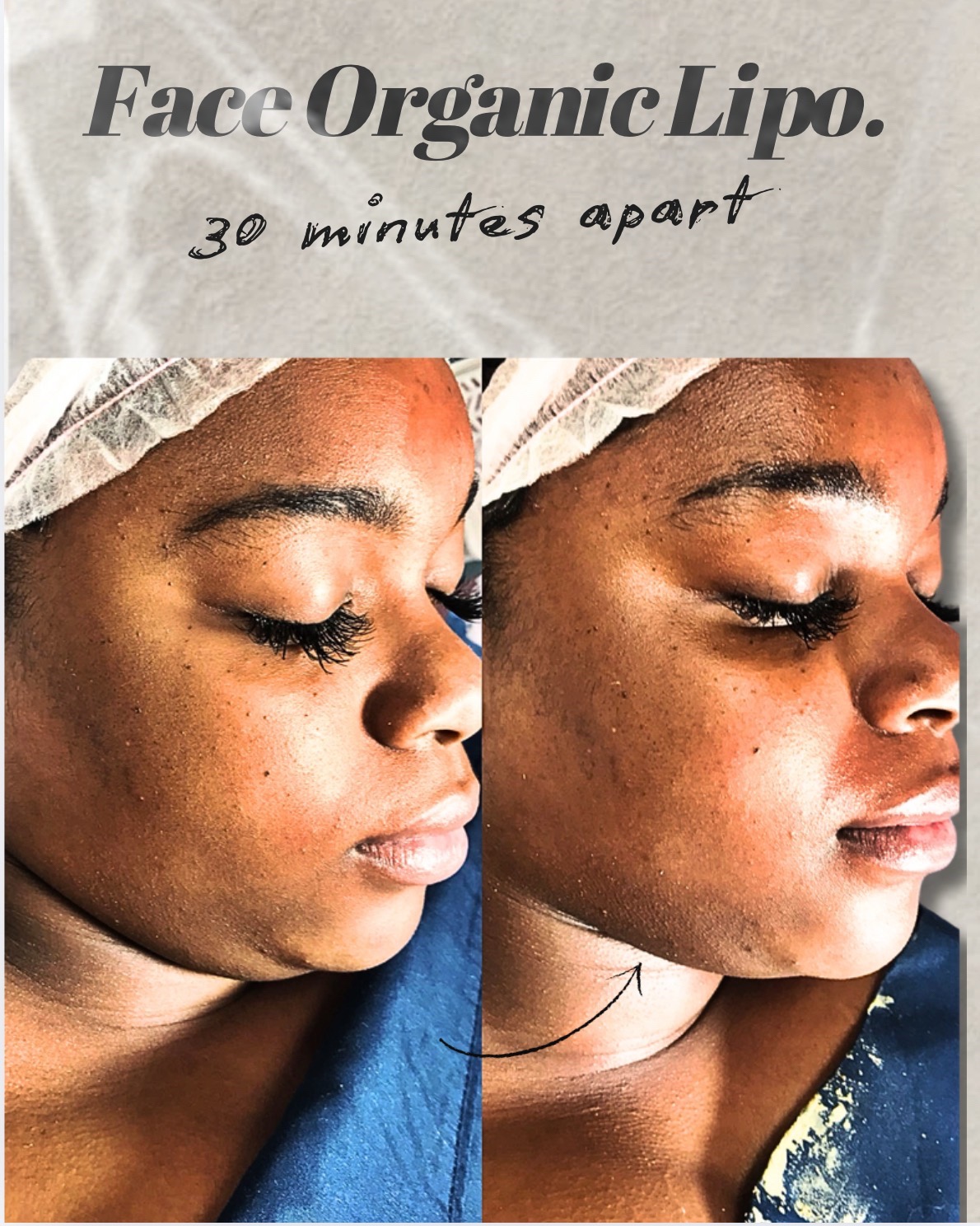 @Atlanta Esthetician & Facials