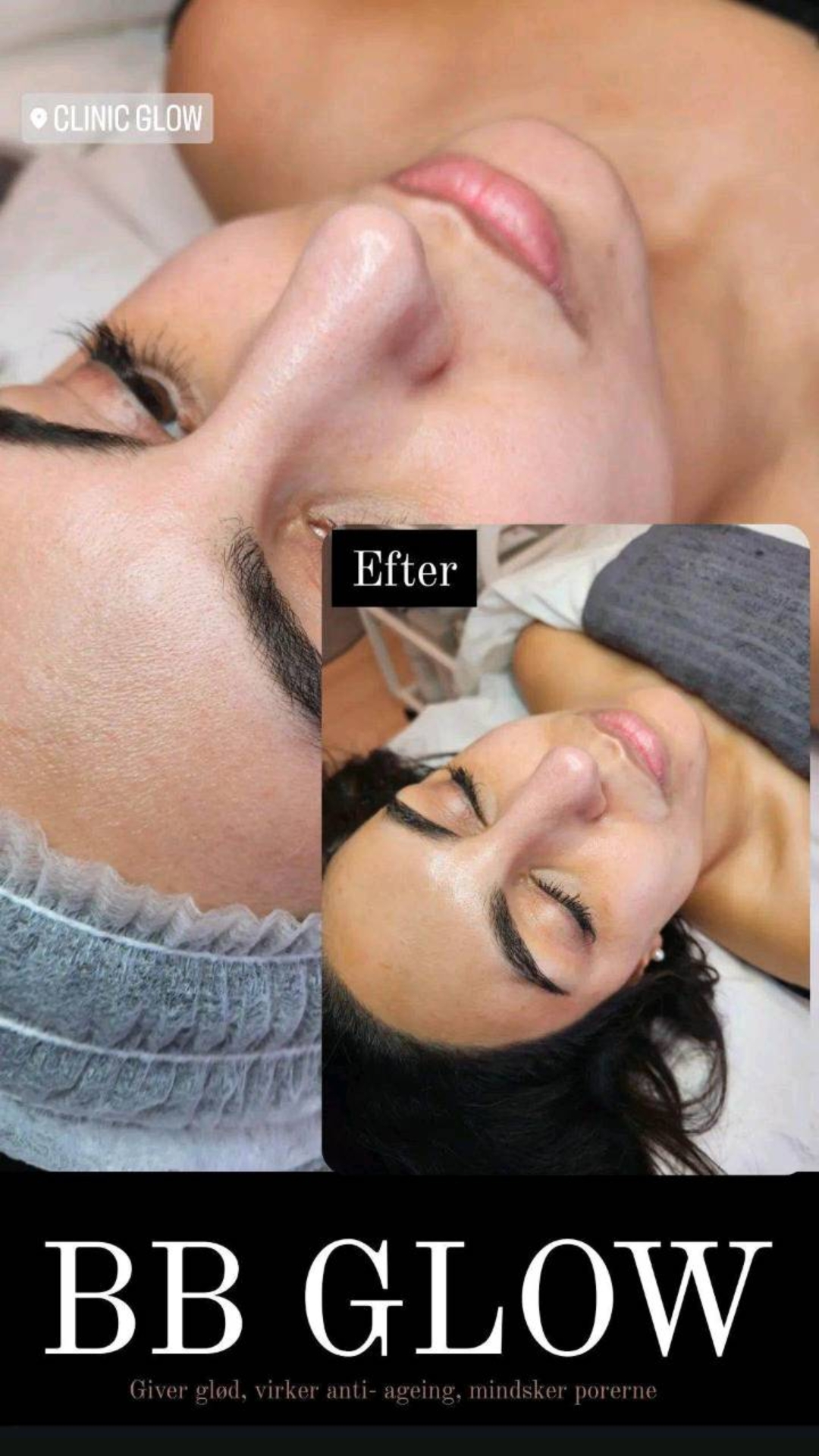 @Clinicglowdk