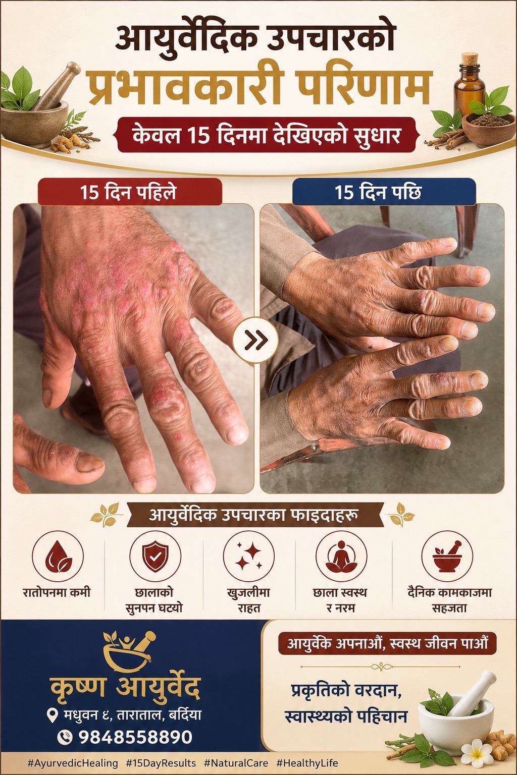 @कृष्ण आयुर्वेद