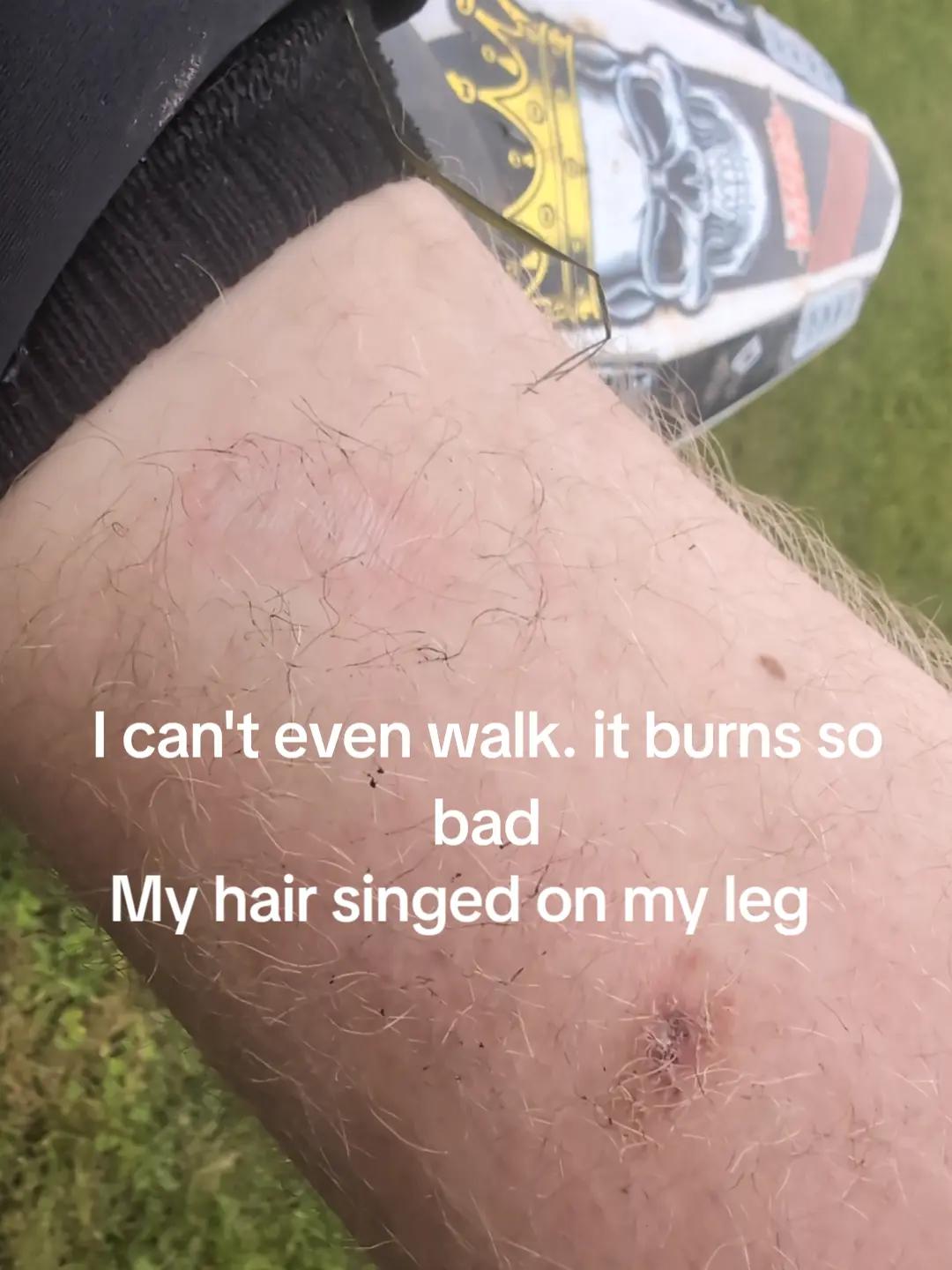 @dirtbikerider