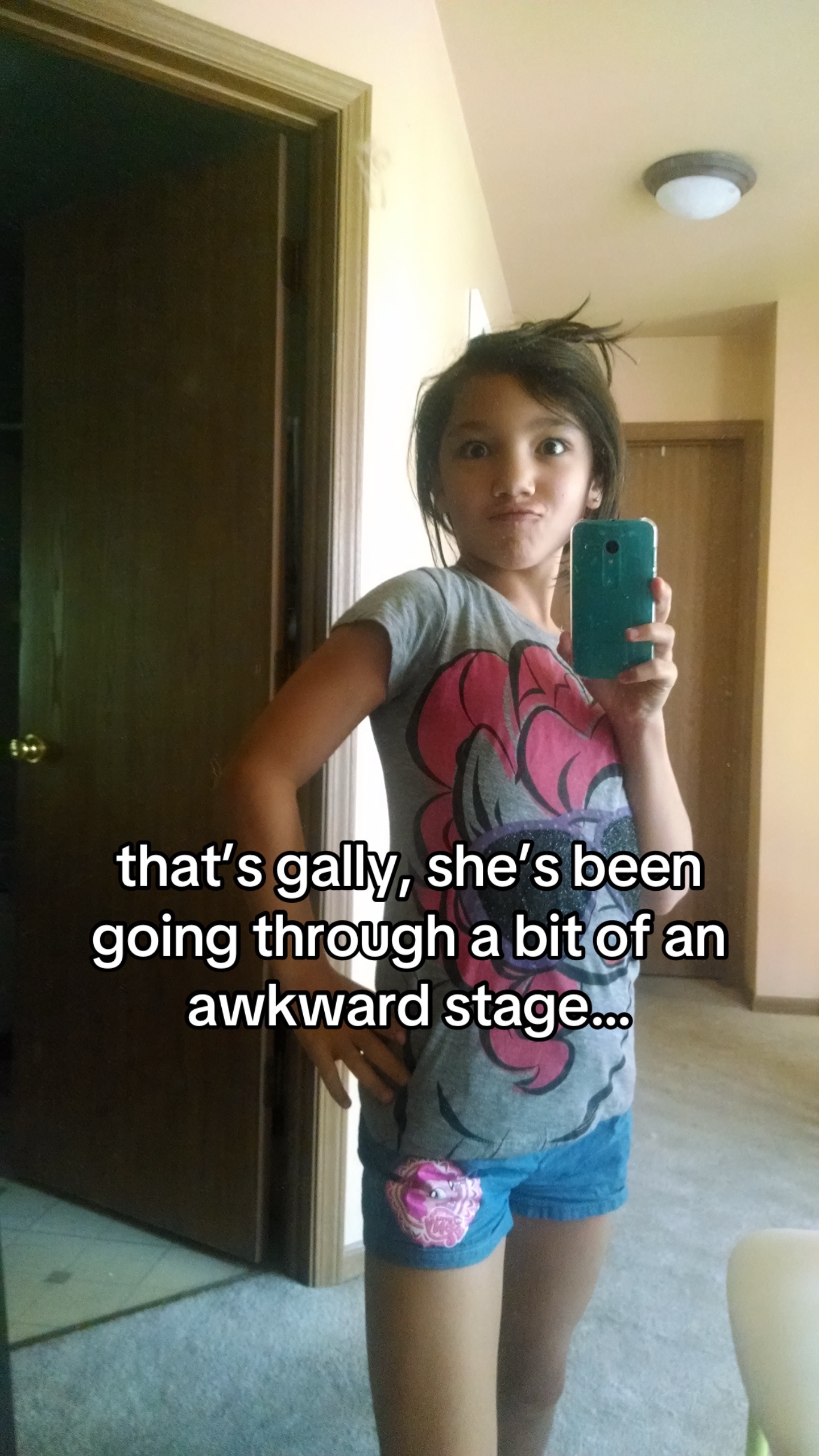 @gally <3