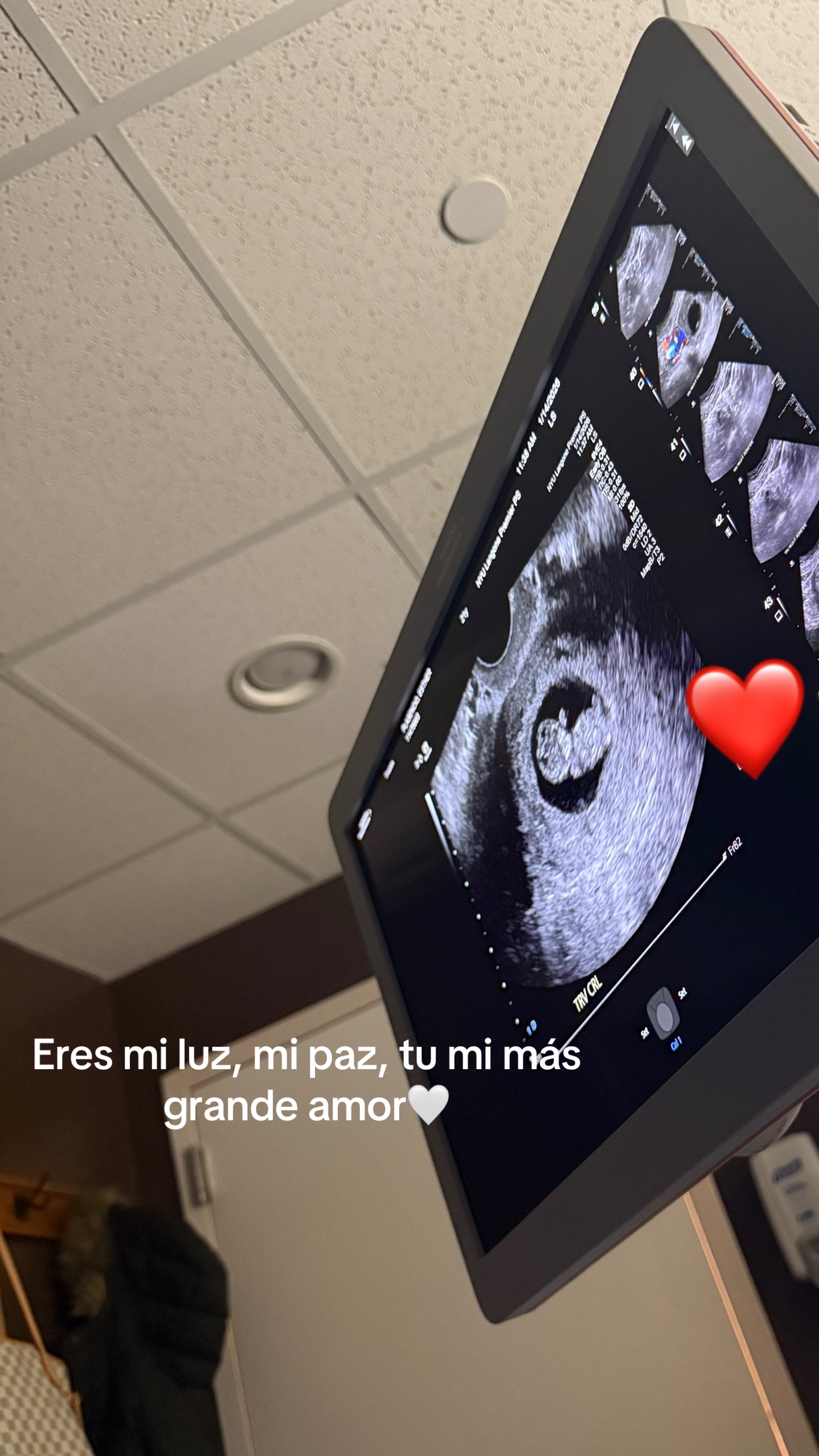 @estherxjosue