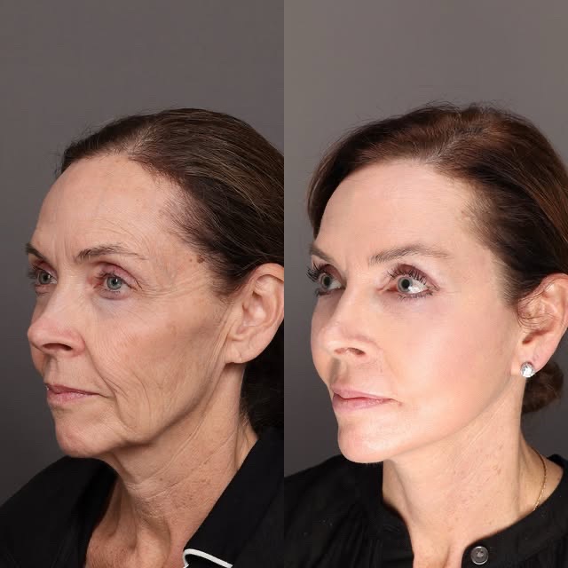 @Xue Skin & Contour