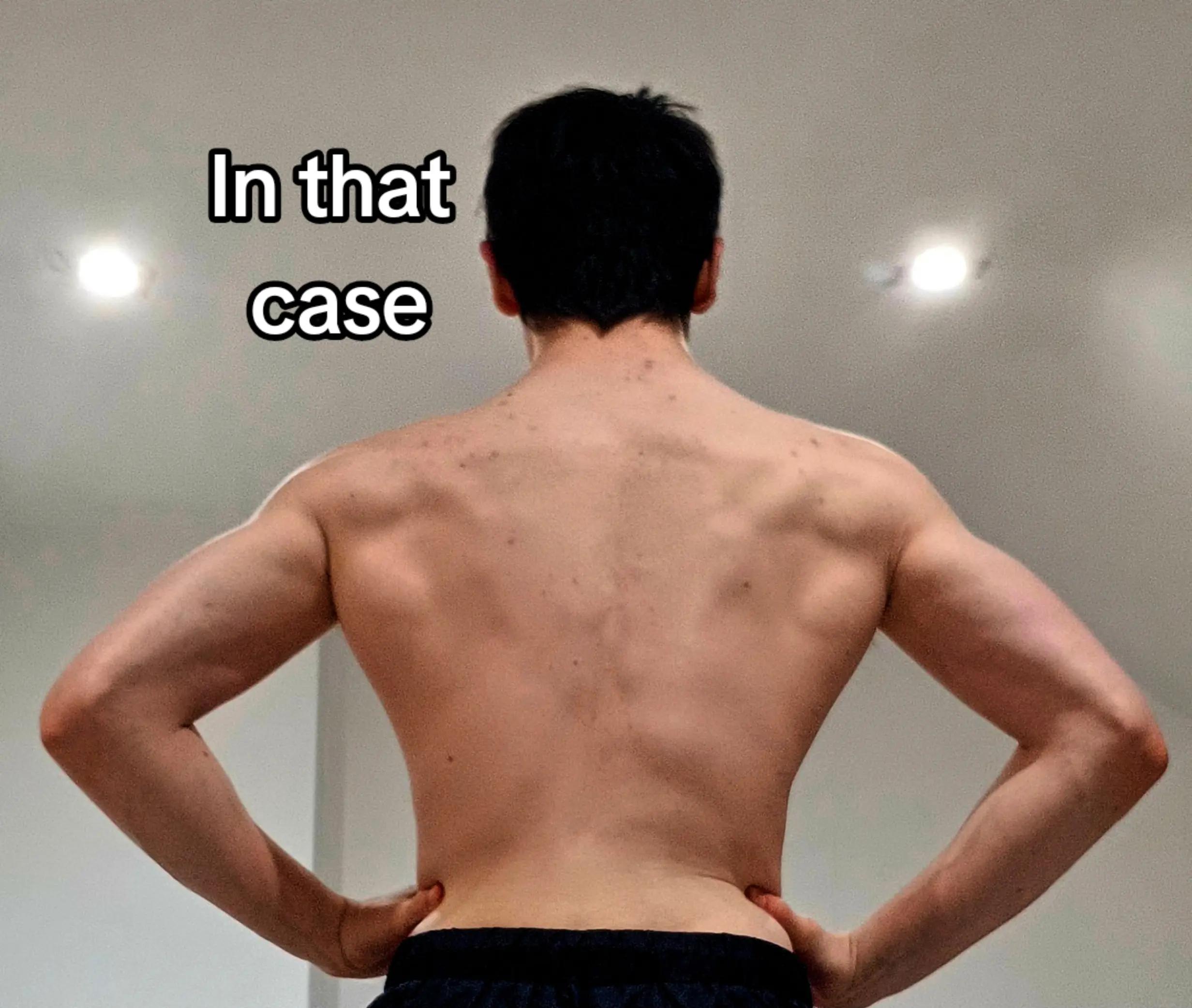 @AlexanderLifts